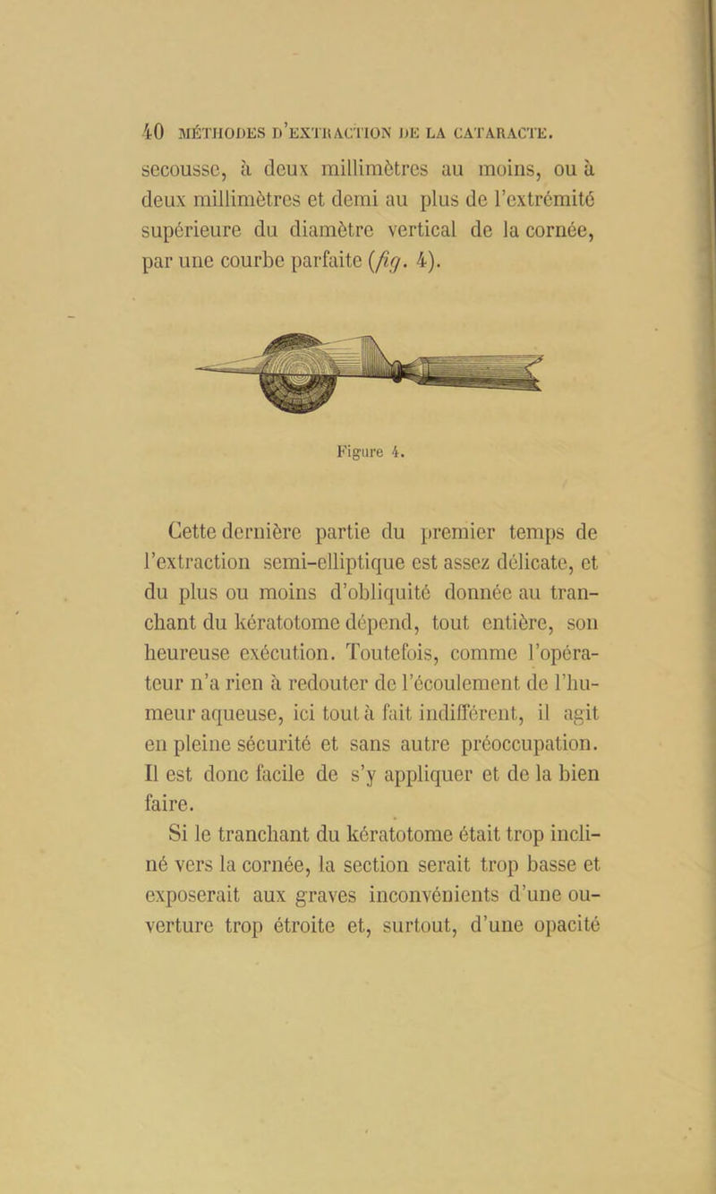 secousse, à deux millimètres au moins, ou à deux millimètres et demi au plus de l’extrémité supérieure du diamètre vertical de la cornée, par une courbe parbiite {ficj. 4). Figure 4. Cette dernière partie du premier temps de l’extraction semi-elliptique est assez délicate, et du plus ou moins d’obliquité donnée au tran- chant du kératotome dépend, tout entière, son heureuse exécution. Toutefois, comme l’opéra- teur n’a rien à redouter de l’écoulement de l’hu- meur aqueuse, ici tout à fait indifférent, il agit en pleine sécurité et sans autre préoccupation. Il est donc facile de s’y appliquer et de la bien faire. Si le tranchant du kératotome était trop incli- né vers la cornée, la section serait trop basse et exposerait aux graves inconvénients d’une ou- verture trop étroite et, surtout, d’une opacité