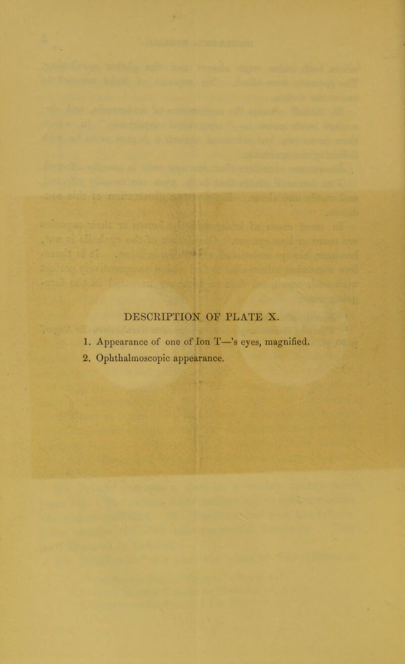 DESCRIPTION OF PLATE X. 1. Appearance of one of Ion T—’s eyes, magnified. 2. Ophthalmoscopic appearance.
