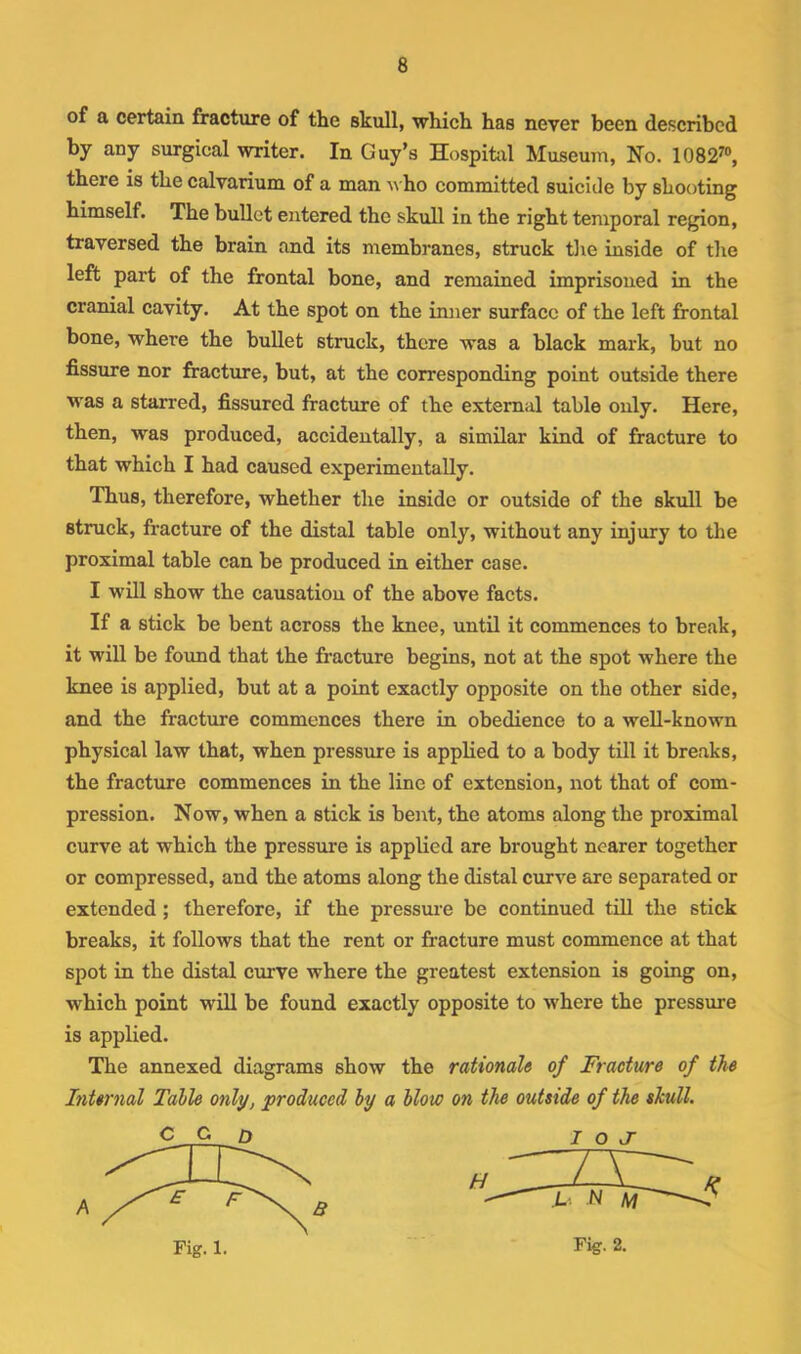 of a certain fracture of the skull, which has never been described by any surgical writer. In Guy’s Hospital Museum, No. 1082^®, there is the calvarium of a man '\^'ho committed suicide by shooting himself. The bullet entered the skull in the right temporal region, traversed the brain and its membranes, struck the inside of the left part of the frontal bone, and remained imprisoned in the cranial cavity. At the spot on the inner surface of the left frontal bone, where the bullet struck, there was a black mark, but no fissure nor fracture, but, at the corresponding point outside there M'as a starred, fissured fracture of the external table only. Here, then, was produced, accidentally, a similar kind of fracture to that which I had caused experimentally. Thus, therefore, whether the inside or outside of the skull be struck, fracture of the distal table only, without any injury to the proximal table can be produced in either case. I will show the causation of the above facts. If a stick be bent across the knee, until it commences to break, it will be found that the fracture begins, not at the spot where the knee is applied, but at a point exactly opposite on the other side, and the fracture commences there in obedience to a well-known physical law that, when pressure is applied to a body till it breaks, the fracture commences in the line of extension, not that of com- pression. Now, when a stick is bent, the atoms along the proximal curve at which the pressure is applied are brought nearer together or compressed, and the atoms along the distal curve are separated or extended; therefore, if the pressure be continued till the stick breaks, it follows that the rent or fracture must commence at that spot in the distal curve where the greatest extension is going on, which point will be found exactly opposite to where the pressure is applied. The annexed diagrams show the rationale of Fracture of the Internal Tails only, produced by a blow on the outside of the shull. Fig. 1. Fig. 2.