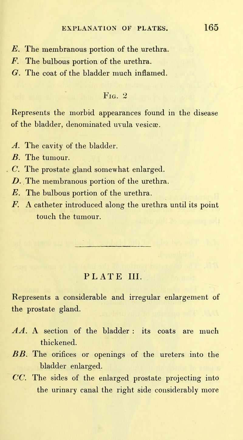 E. The membranous portion of the urethra. F. The bulbous portion of the urethra. G. The coat of the bladder much inflamed. Fig. 2 Represents the morbid appearances found in the disease of the bladder, denominated uvula vesicae. A. The cavity of the bladder. B. The tumour. C. The prostate gland somewhat enlarged. D. The membranous portion of the urethra. E. The bulbous portion of the urethra. F. A catheter introduced along the urethra until its point touch the tumour. PLATE III. Represents a considerable and irregular enlargement of the prostate gland. A A. A section of the bladder : its coats are much thickened. BB. The orifices or openings of the ureters into the bladder enlarged. CC. The sides of the enlarged prostate projecting into the urinary canal the right side considerably more