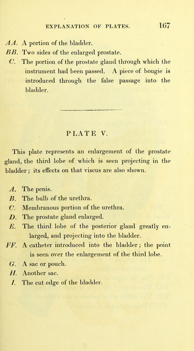 A A. A portion of the bladder. BB. Two sides of the enlarged prostate. C. The portion of the prostate gland through which the instrument had been passed. A piece of bougie is introduced through the false passage into the bladder. PLATE V. This plate represents an enlargement of the prostate gland, the third lobe of which is seen projecting in the bladder; its effects on that viscus are also shown. A. The penis. B. The bulb of the urethra. C. Membranous portion of the urethra. D. The prostate gland enlarged. E. The third lobe of the posterior gland greatly en- larged, and projecting into the bladder. FF. A catheter introduced into the bladder; the point is seen over the enlargement of the third lobe. G. A sac or pouch. H. Another sac. I. The cut edge of the bladder.