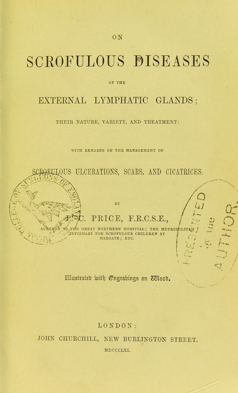 IV' SCROFULOUS ©ISEASES OF THE EXTERNAL LYMPHATIC GLANDS; THEIK NATUEE, VAEIETY, AND TEEATMENT: WITH REMARKS OK THE MANAGEMEKT OF LONDON: JOHN CHURCHILL, NE-W BURLINGTON STREET. MDCCCLXI.