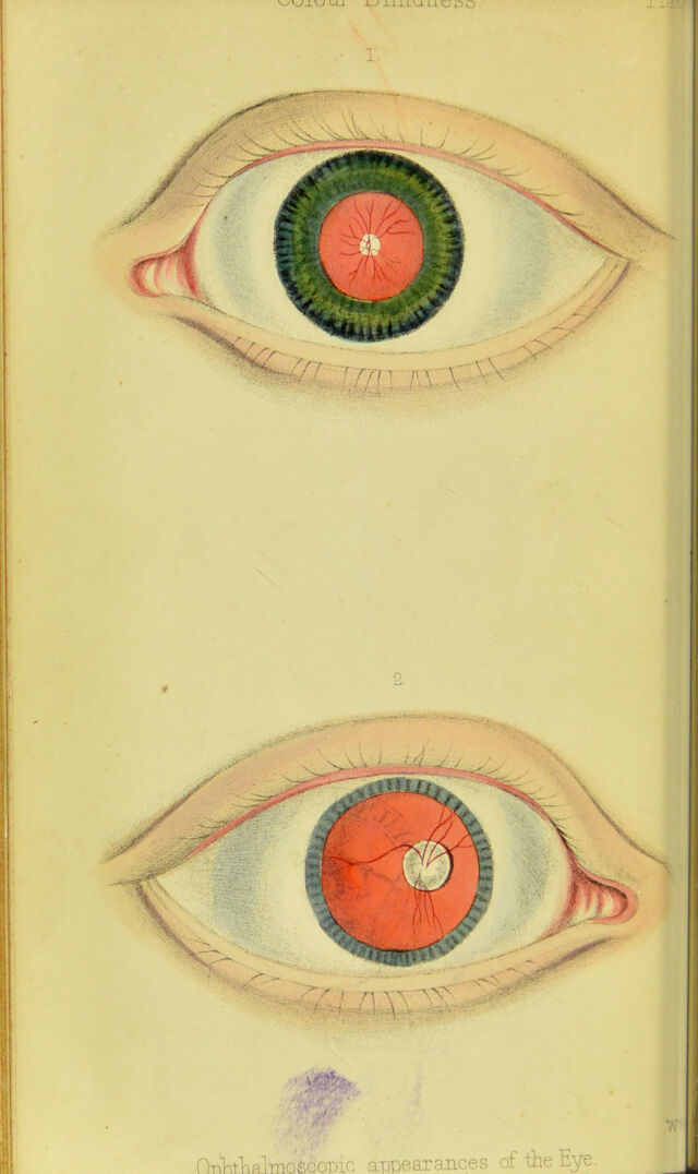 digitised image 2