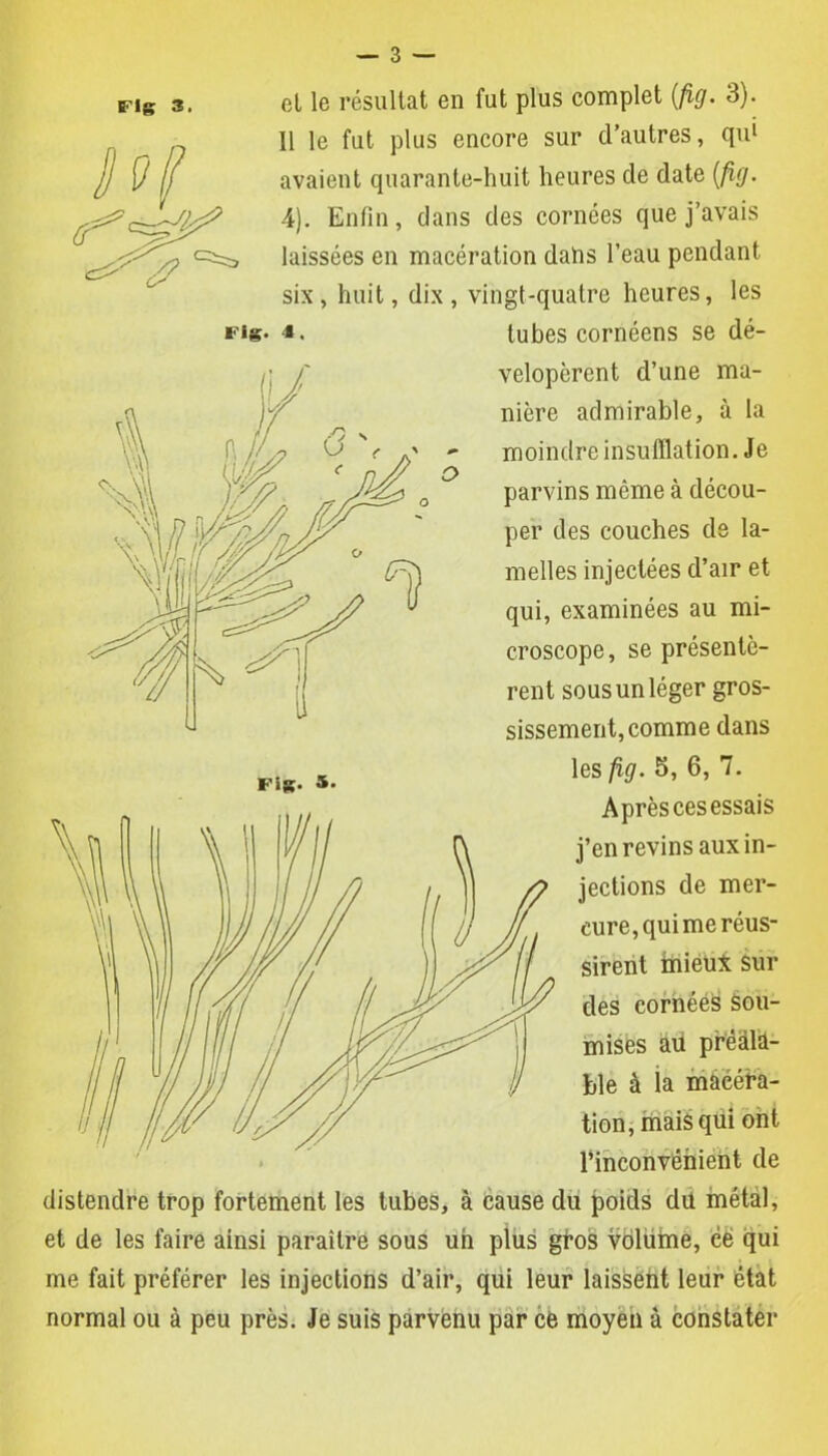 Fig 3, n et le résultat en fut plus complet (fig. 3). 11 le fut plus encore sur d’autres, qui avaient quarante-huit heures cle date (fig. 4). Enfin, dans des cornées que j’avais laissées en macération dahs l’eau pendant six, huit, dix, vingt-quatre heures, les «■’ig- ■*. tubes cornéens se dé- velopèrent d’une ma- nière admirable, à la moindre insufflation. Je parvins môme à décou- per des couches de la- melles injectées d’air et qui, examinées au mi- croscope, se présentè- rent sous un léger gros- sissement, comme dans les fig. 5, 6, 7. Après ces essais j’en revins aux in- jections de mer- cure, qui me réus- sirent mieux sui- des eornééS sou- mises au préala- ble à la macéra- tion, mais qui ont l’inconvénient de distendre trop fortement les tubes, à cause du poids du métal, et de les faire ainsi paraître sous un plus gros volume, ce qui me fait préférer les injections d’air, qui leur laissent leur état normal ou à peu près. Je suis parvenu par ce moyen à constater