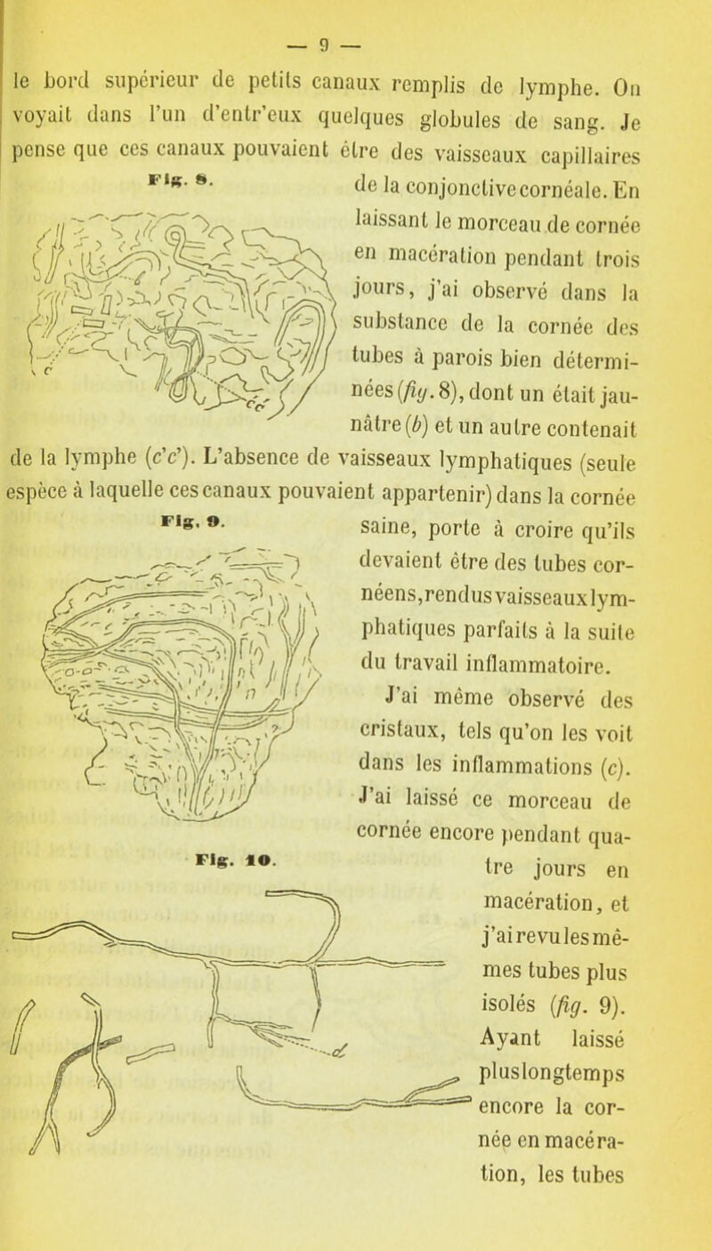 ■QC 1g bord supérieur de petits canaux remplis de lymphe. Ou voyait dans l’un d’entr’eux quelques globules de sang. Je pense que ces canaux pouvaient être des vaisseaux capillaires de la conjonctivecornéale. En laissant le morceau de cornée en macération pendant trois jours, j’ai observé dans la substance de la cornée des tubes à parois bien détermi- nées (fuj. 8), dont un était jau- nâtre^) et un autre contenait de la lymphe (cV). L’absence de vaisseaux lymphatiques (seule espèce à laquelle ces canaux pouvaient appartenir) dans la cornée vi» n _ _ • j  v iMfVv-V -J fi». ». saine, porte à croire qu’ils devaient être des tubes cor- néens, rendus vaisseaux lym- phatiques parfaits à la suite du travail inflammatoire. J’ai même observé des cristaux, tels qu’on les voit dans les inflammations (c). J ai laissé ce morceau de cornée encore pendant qua- tre jours en macération, et j’ai revu les mê- mes tubes plus isolés (fig. 9). Ayant laissé pluslongtemps encore la cor- née en macéra- tion, les tubes