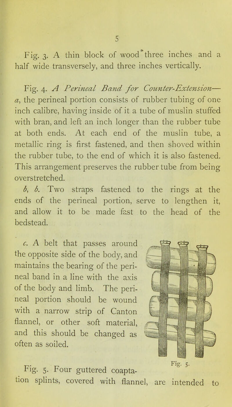 Fig. 3. A thin block of wood*three inches and a half wide transversely, and three inches vertically. Fig. 4. A Perineal Band for Coit7iter-Extension— a, the perineal portion consists of rubber tubing of one inch calibre, having inside of it a tube of muslin stuffed with bran, and left an inch longer than the rubber tube at both ends. At each end of the muslin tube, a metallic ring is first fastened, and then shoved within the rubber tube, to the end of which it is also fastened. This arrangement preserves the rubber tube from being overstretched. b, b. Two straps fastened to the rings at the ends of the perineal portion, serve to lengthen it, and allow it to be made fast to the head of the bedstead. c. A belt that passes around the opposite side of the body, and maintains the bearing of the peri- neal band in a line with the axis of the body and limb. The peri- neal portion should be wound with a narrow strip of Canton flannel, or other soft material, and this should be changed as often as soiled. Fig. 5. Four guttered coapta- tion splints, covered with flannel, are intended to