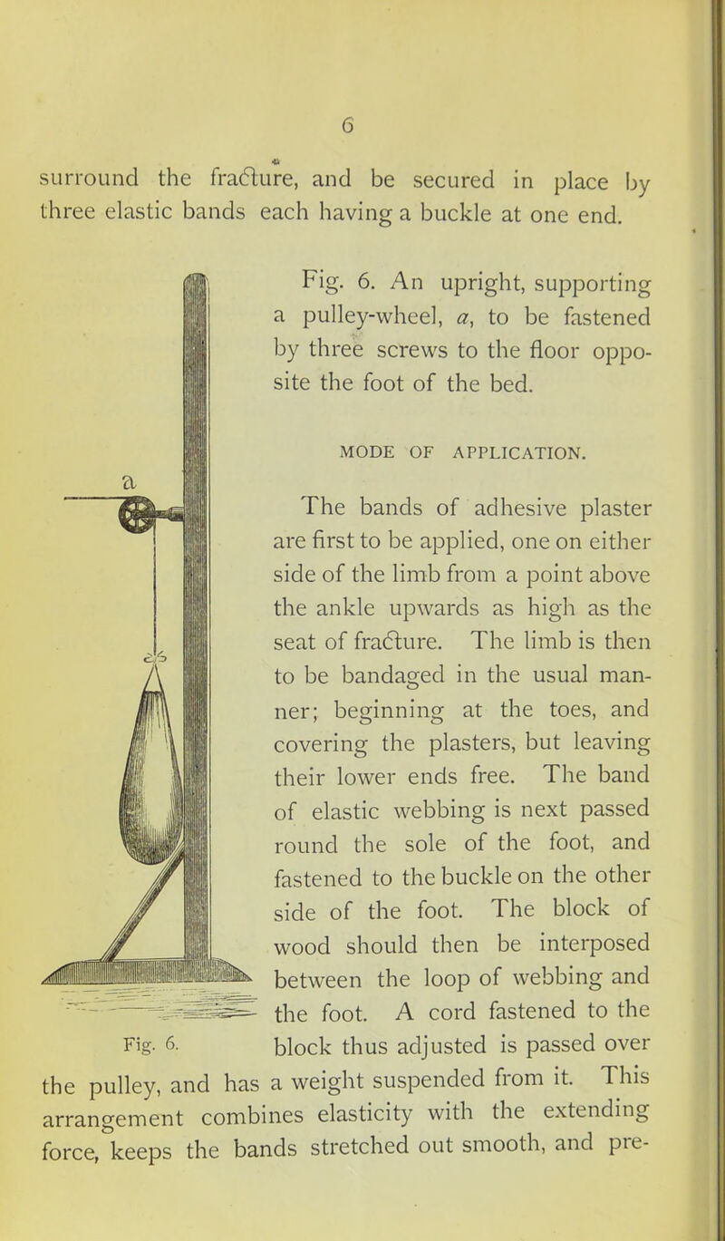 surround the fradure, and be secured in place by three elastic bands each having a buckle at one end. Fig. 6. An upright, supporting a pulley-wheel, a, to be fastened by three screws to the floor oppo- site the foot of the bed. MODE OF APPLICATION. The bands of adhesive plaster are first to be applied, one on either side of the limb from a point above the ankle upwards as high as the seat of fradure. The limb is then to be bandaged in the usual man- ner; beginning at the toes, and covering the plasters, but leaving their lower ends free. The band of elastic webbing is next passed round the sole of the foot, and fastened to the buckle on the other side of the foot. The block of wood should then be interposed between the loop of webbing and the foot. A cord fastened to the Fig. 6- block thus adjusted is passed over the pulley, and has a weight suspended from it. This arrangement combines elasticity with the extending force, keeps the bands stretched out smooth, and pre-