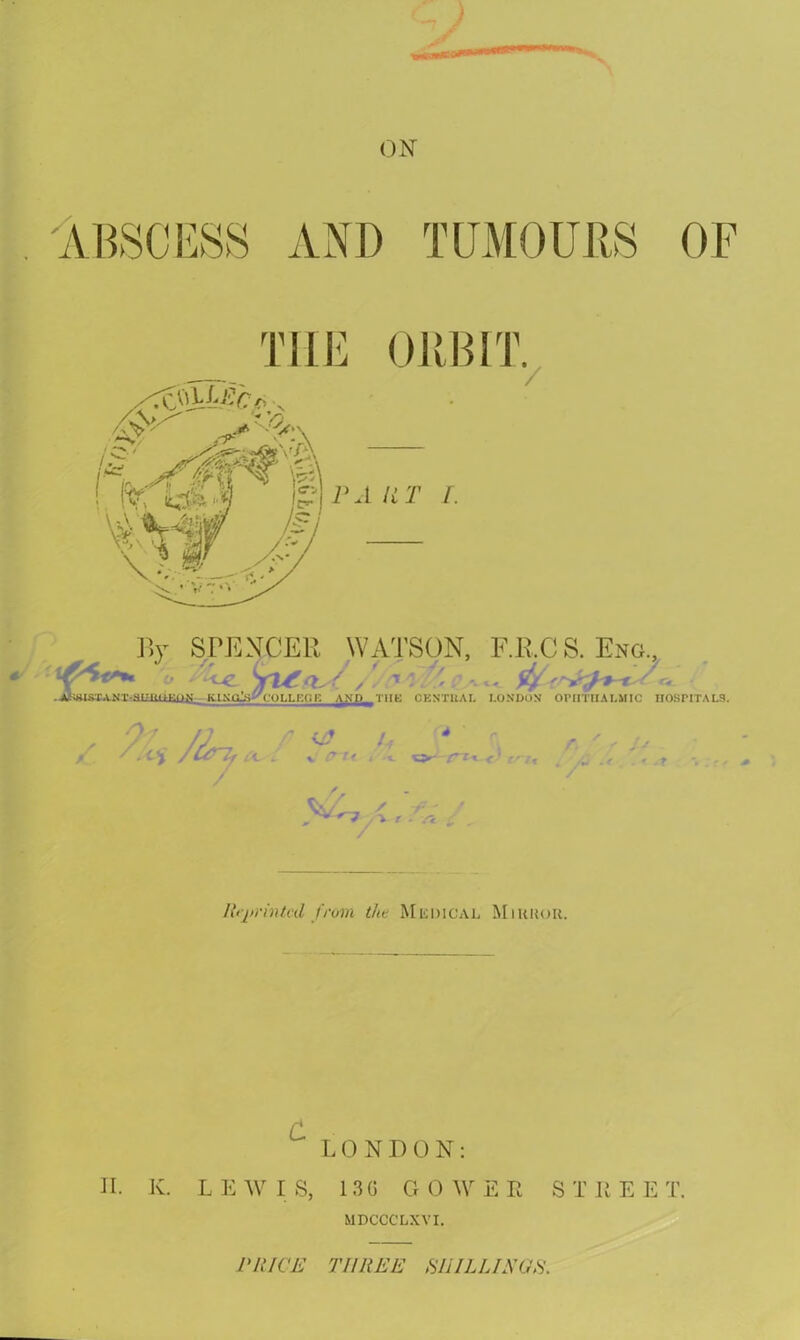 ON YBSCESS AND TUMOURS OF THE ORBIT. 7 p a a t /. By SPENCER WATSON, F.R.CS. Eng., # o > *-ce T . 7 ^ ' ct .-AhttigTAMT-smiiHirm KLXQlsA-ULLKtiF. AND THE CENT11AL LONDON OPHTHALMIC HOSPITALS. . 7/ /] /) <0 Lf 4; r r. ' ' S' / . /C&'Tf £C--~ V < •«- car--en« .. .<• . » - Reprinted from the Medical Miuuor. C LONDON: II. K. L E W I 8, 13G GO W E E S T E E E T. MDCCCLXVI. PRICE THREE SHILLINGS.