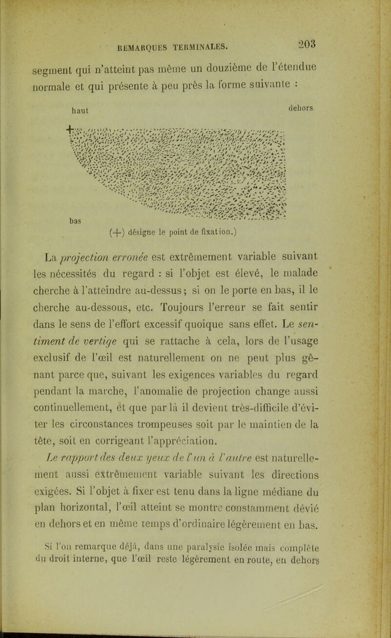 segment qui n’atteint pas même un douzième de l’étendue normale et qui présente à peu près la forme suivante : dehors (-{-) désigne le point de fixation.) La projection erronée est extrêmement variable suivant les nécessités du regard : si l’objet est élevé, le malade cherche à l’atteindre au-dessus ; si on le porte en bas, il le cherche au-dessous, etc. Toujours l’erreur se fait sentir dans le sens de l’effort excessif quoique sans effet. Le sen- timent de vertige qui se rattache à cela, lors de l’usage exclusif de l’œil est naturellement on ne peut plus gê- nant parce que, suivant les exigences variables du regard pendant la marche, l’anomalie de projection change aussi continuellement, et que parla il devient très-difficile d’évi- ter les circonstances trompeuses soit par le maintien de la tête, soit en corrigeant l’appréciation. Le rapport des deux yeux de l'un à l'autre est naturelle- ment aussi extrêmement variable suivant les directions exigées. Si l’objet à fixer est tenu dans la ligne médiane du plan horizontal, l’œil atteint sc montre constamment dévié en dehors et en même temps d’ordinaire légèrement en bas. Si l’on remarque déjà, dans une paralysie isolée mais complète du droit interne, que l’œil reste légèrement en route, en dehors