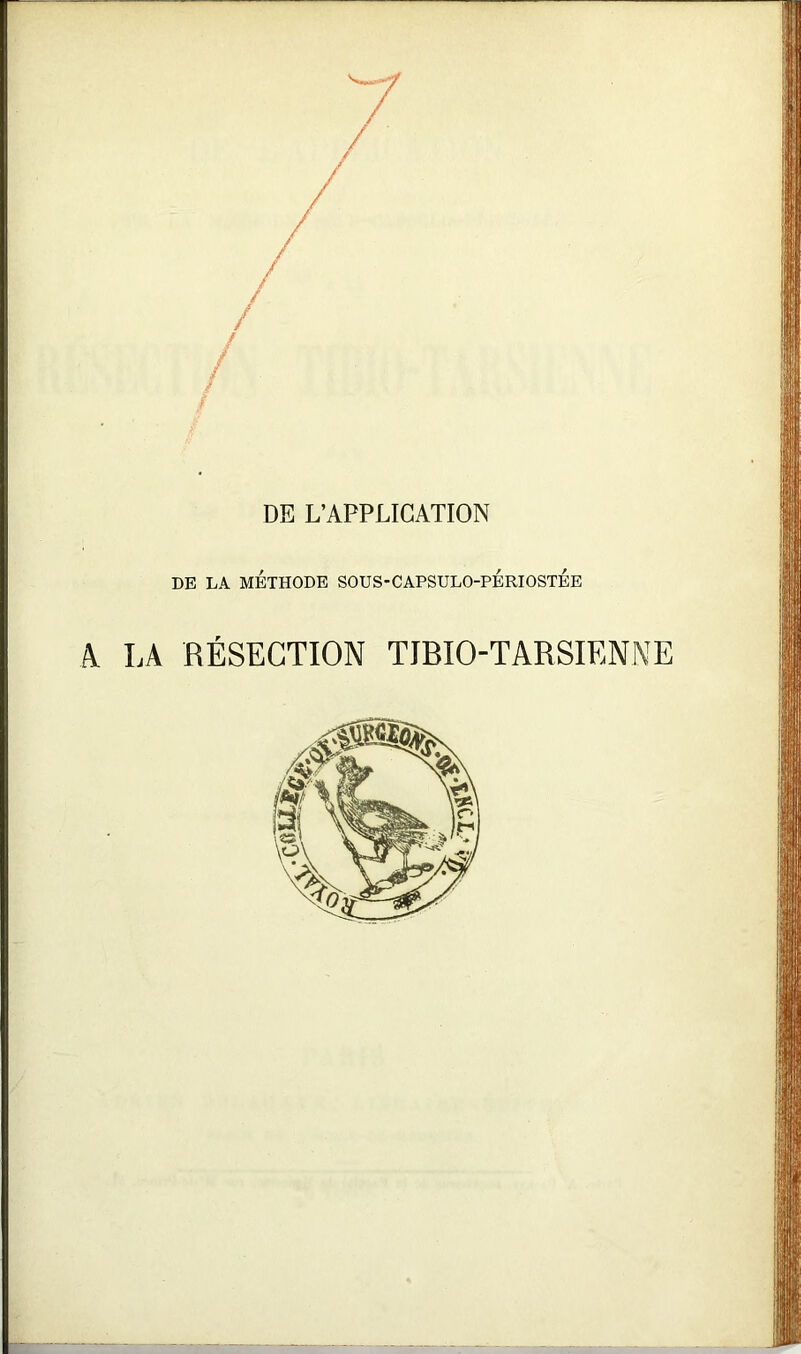 DE L’APPLICATION DE LA MÉTHODE SOUS-CAPSULO-PÉRIOSTÉE A. LA RÉSECTION TIBIO-TARSIENNE