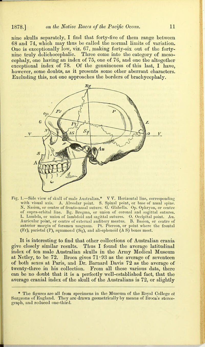 nine skulls separately, I find that forty-five of them range between 68 and 74, which may thus be called the normal limits of variation. One is exceptionally low, viz. 67, making forty-six out of the forty- nine truly dolichocephalic. Three come into the category of meso- cephaly, one having an index of 75, one of 76, and one the altogether exceptional index of 78. Of the genuineness of this last, I have, however, some doubts, as it presents some other aberrant characters. Excluding this, not one approaches the borders of brachycephaly. Fig. 1.—Side view of skull of male Australian.* W. Horizontal line, corresponding with visual axis. A. Alveolar point. S. Spinal point, or, base of nasal spine. N. Nasion, or centre of fronto-nasal suture. G. Glabella. Op. Ophryon, or centre of supra-orbital line. Bg. Bregma, or union of coronal and sagittal sutures. L. Lambda, or union of lambdoid and sagittal sutures. 0. Occipital point. Au. Auricular point, or centre of external auditory meatus. B. Basion, or centre of anterior margin of foramen magnum. Pt. Ptereon, or point where the frontal (Fi-), parietal (P), squamosal (Sq), and ali-sphenoid (A S) bones meet. It is interesting to find that other collections of Australian crania give closely similar results. Thus I found the average latitudinal index of ten male Australian skulls in the Army Medical Museum at Netley, to be 72. Broca gives 71’93 as the average of seventeen of both sexes at Paris, and Dr. Barnard Davis 72 as the average of twenty-three in his collection. From all these various data, there can bo no doubt that it is a perfectly well-established fact, that the average cranial index of the skull of the Australians is 72, or slightly * The figures nre all from specimens in the Museum of the Eoyal College ot Surgeons of England. They are drawn geometrically by means of Broca’s stereo- graph, and reduced one-third.