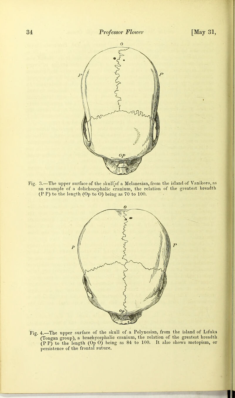 o Fig. 3.—The upper surface of the skulFof a Melanesian, from the island of Vanikoro, as an example of a dolichocephalic cranium, the relation of the greatest breadth (P P) to the length (Op to O) being as 70 to 100. pjg. 4. The upper surface of the skull of a Polynesian, from the island of Lifuka (Tongan group), a brachycephalic cranium, the relation of the greatest breadth (P P) to the length (Op 0) being as 84 to 100. It also shows raetopism, or persistence of the frontal suture.