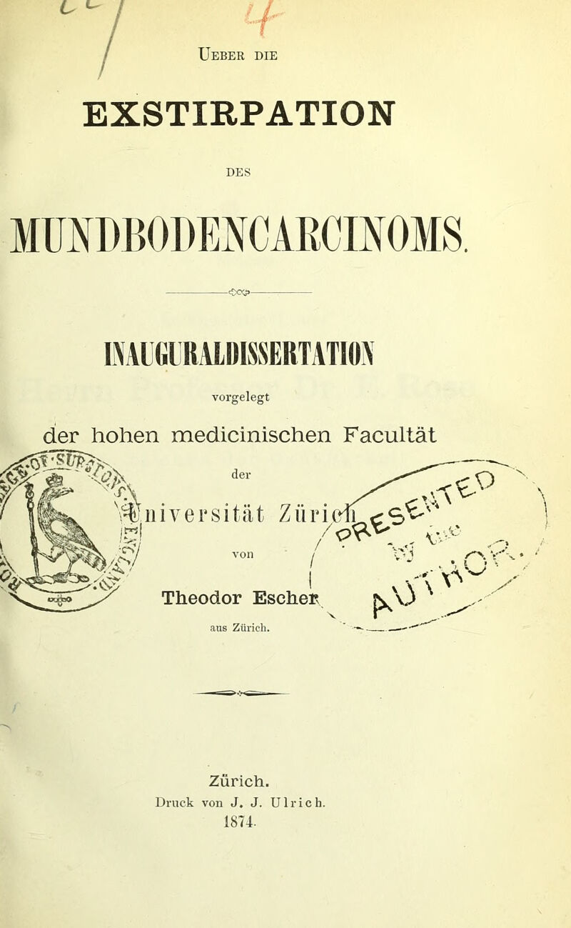 Ueber die EXSTIRPATION DES MÜNDBODEiNCARCmOMS. vorgelegt der hohen medicinischen Facultät Zürich. Druck von J, J. Ulrich.