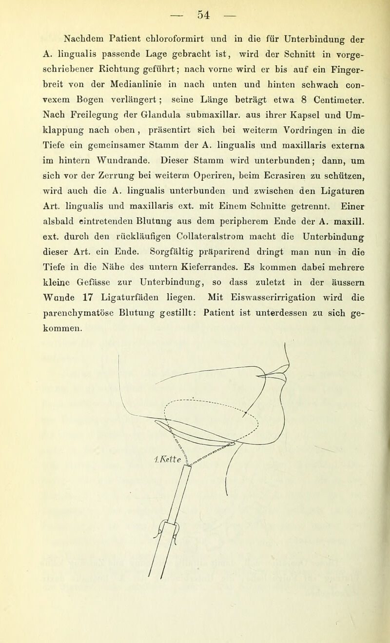 Nachdem Patient chloroformirt und in die für Unterbindung der A. lingualis passende Lage gebracht ist, wird der Schnitt in vorge- schriebener Richtung geführt; nach vorne wird er bis auf ein Finger- breit von der Medianlinie in nach unten und hinten schwach con- vexem Bogen verlängert; seine Länge beträgt etwa 8 Centimeter. Nach Freilegung der Glandula submaxillar. aus ihrer Kapsel und Um- klappung nach oben, präsentirt sich bei weiterm Vordringen in die Tiefe ein gemeinsamer Stamm der A. lingualis und maxillaris externa im hintern Wundrande. Dieser Stamm wird unterbunden; dann, um sich vor der Zerrung bei weiterm Operiren, beim Ecrasiren zu schützen, wird auch die A. lingualis unterbunden und zwischen den Ligaturen Art. lingualis und maxillaris ext. mit Einem Schnitte getrennt. Einer alsbald eintretenden Blutung aus dem peripherem Ende der A. maxill. ext. durch den rückläufigen Collateralstrom macht die Unterbindung dieser Art. ein Ende. Sorgfältig präparirend dringt man nun in die Tiefe in die Nähe des untern Kieferrandes. Es kommen dabei mehrere kleine Gefässe zur Unterbindung, so dass zuletzt in der äussern Wunde 17 Ligaturfäden liegen. Mit Eiswasserirrigation wird die parenchymatöse Blutung gestillt: Patient ist unterdessen zu sich ge- kommen.