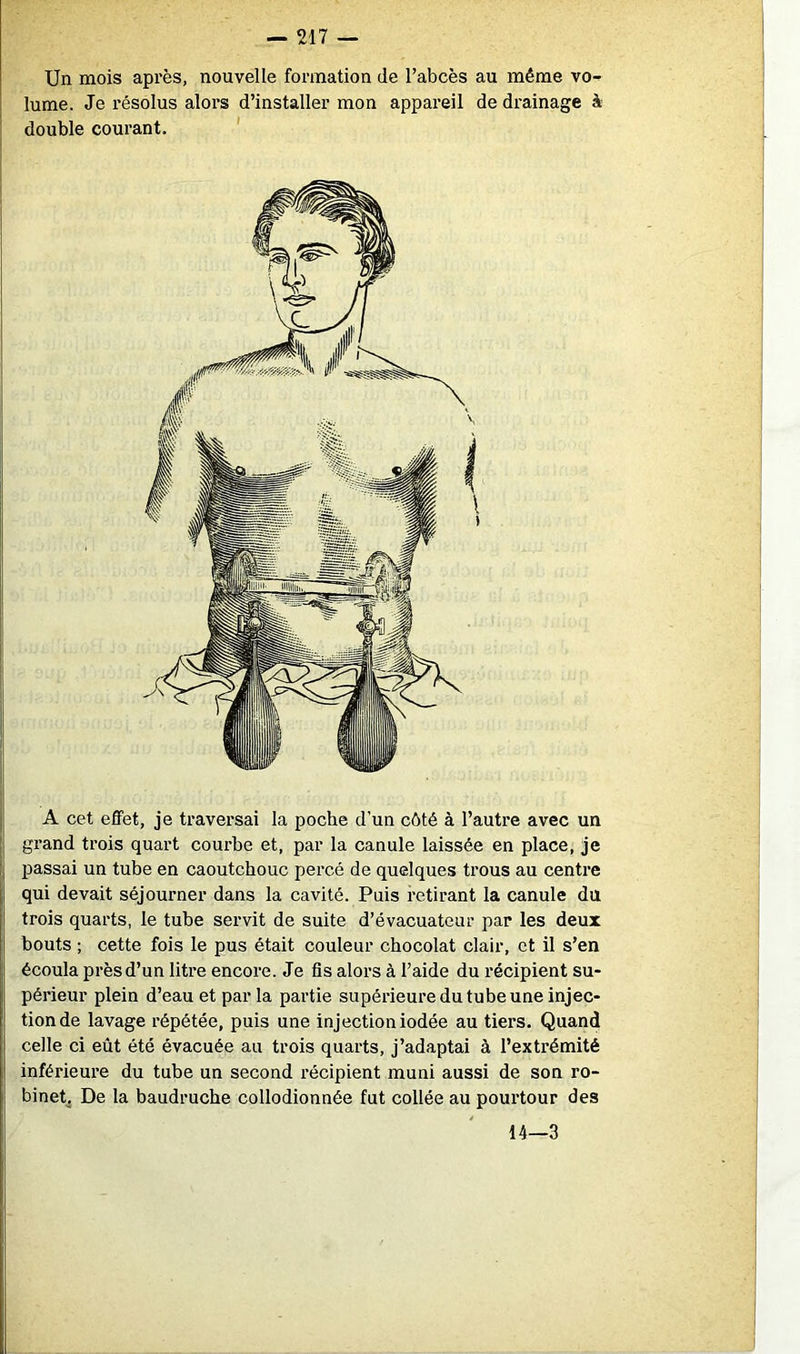 Un mois après, nouvelle formation de l’abcès au même vo- lume. Je résolus alors d’installer mon appai-eil de drainage à double courant. ’ A cet effet, je traversai la poche d’un côté à l’autre avec un grand trois quart courbe et, par la canule laissée en place, je passai un tube en caoutchouc percé de quelques trous au centre qui devait séjourner dans la cavité. Puis retirant la canule da trois quarts, le tube servit de suite d’évacuateur par les deux bouts ; cette fois le pus était couleur chocolat clair, et il s’en écoula près d’un litre encore. Je fis alors à l’aide du récipient su- périeur plein d’eau et par la partie supérieure du tube une injec- tion de lavage répétée, puis une injection iodée au tiers. Quand celle ci eût été évacuée au trois quarts, j’adaptai à l’extrémité inférieure du tube un second récipient muni aussi de son ro- binet. De la baudruche collodionnée fut collée au pourtour des 14—3