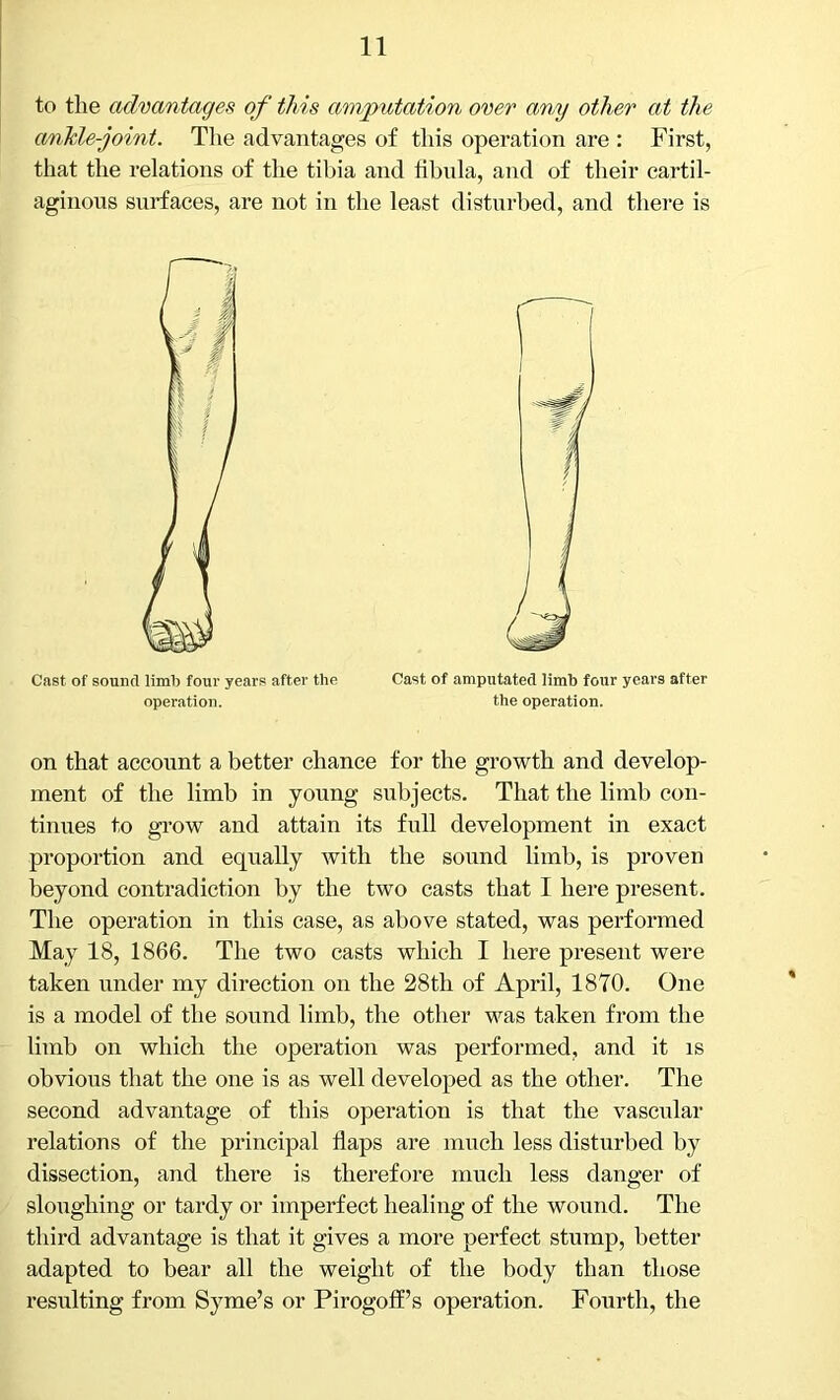 to the advantages of this amputation over any other at the ankle-joint. The advantages of this operation are : First, that the relations of the tibia and fibula, and of their cartil- aginous surfaces, are not in the least disturbed, and there is on that account a better chance for the growth and develop- ment of the limb in young subjects. That the limb con- tinues to grow and attain its full development in exact proportion and equally with the sound limb, is proven beyond contradiction by the two casts that I here present. The operation in this case, as above stated, was performed May 18, 1866. The two casts which I here present were taken under my direction on the 28th of April, 1870. One is a model of the sound limb, the other was taken from the limb on which the operation was performed, and it is obvious that the one is as well developed as the other. The second advantage of this operation is that the vascular relations of the principal flaps are much less disturbed by dissection, and there is therefore much less danger of sloughing or tardy or imperfect healing of the wound. The third advantage is that it gives a more perfect stump, better adapted to bear all the weight of the body than those resulting from Syme’s or Pirogoff’s operation. Fourth, the Cast of sound liml) four years after the operation. Cast of amputated limb four years after the operation.