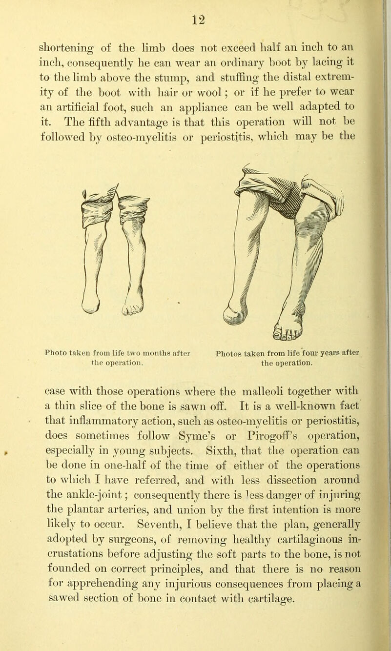 shortening of the limb does not exceed half an inch to an inch, consequently he can wear an ordinary boot by lacing it to the limb above the stump, and stuffing the distal extrem- ity of the boot with hair or wool; or if he prefer to wear an artificial foot, such an appliance can be well adapted to it. The fifth advantage is that this operation will not be followed by osteo-myelitis or periostitis, which may be the Photo taken from life two months after Photos taken from life four years after the operation. the operation. case with those operations where the malleoli together with a thin slice of the bone is sawn oft’. It is a well-known fact that inflammatory action, such as osteo-myelitis or periostitis, does sometimes follow Syme’s or Pirogoff’s operation, especially in young subjects. Sixth, that the operation can be done in one-half of the time of either of the operations to which I have referred, and with less dissection around the ankle-joint; consequently there is less danger of injuring the plantar arteries, and union by the first intention is more likely to occur. Seventh, I believe that the plan, generally adopted by surgeons, of removing healthy cartilaginous in- crustations before adjusting the soft parts to the bone, is not founded on correct principles, and that there is no reason for apprehending any injurious consequences from placing a sawed section of bone in contact with cartilage.