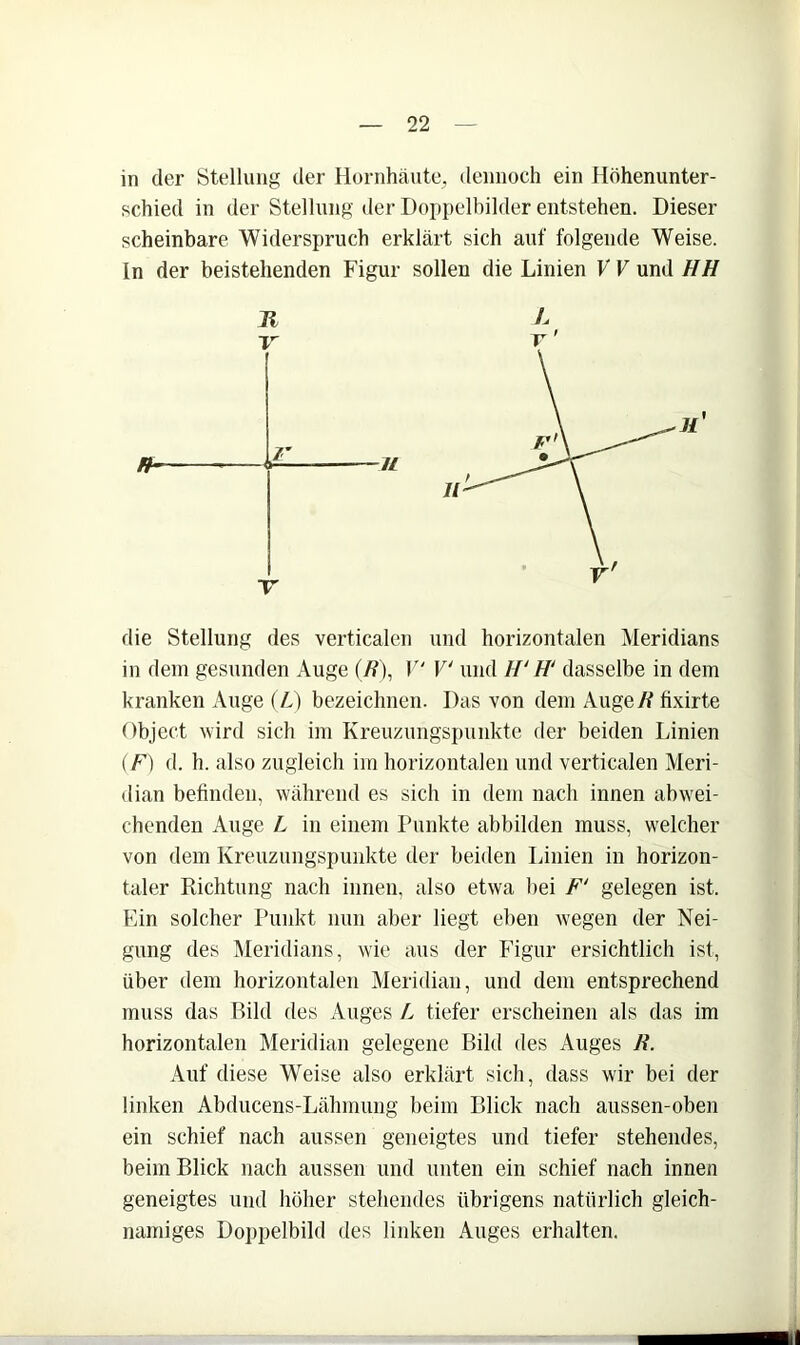 in der Stellung der Hornhäute^ dennoch ein Höhenunter- schied in der Stellung der Doppelbilder entstehen. Dieser scheinbare Widerspruch erklärt sich auf folgende Weise, ln der beistehenden Figur sollen die Linien VV und HH die Stellung des verticalen und horizontalen Meridians in dem gesunden Auge (ß), V' V und H' H' dasselbe in dem kranken Auge (A) bezeichnen. Das von dem Auge/^ fixirte Object wird sich im Kreuzungspunkte der beiden Linien (F) d. h. also zugleich im horizontalen und verticalen Meri- ilian befinden, während es sich in dem nach innen abwei- chenden Auge L in einem Punkte abbilden muss, welcher von dem Kreuzungspimkte der beiden Linien in horizon- taler Richtung nach innen, also etwa bei F' gelegen ist. Ein solcher Punkt nun aber liegt eben wegen der Nei- gung des Meridians, wie aus der Figur ersichtlich ist, über dem horizontalen Meridian, und dem entsprechend muss das Bild des Auges L tiefer erscheinen als das im horizontalen Meridian gelegene Bild des Auges B. Auf diese Weise also erklärt sich, dass wir bei der linken Abducens-Lähmung beim Blick nach aussen-oben ein schief nach aussen geneigtes und tiefer stehendes, beim Blick nach aussen und unten ein schief nach innen geneigtes und höher stehendes übrigens natürlich gleich- namiges Doi)pelbild des linken Auges erhalten.
