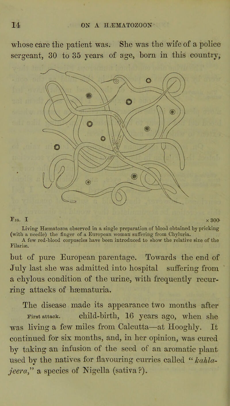 whose care the patient was. She was the wife of a police sergeant, 30 to 35 years of age, born in this country. Tig. I x 300 Living Hmmatozoa observed in a single preparation of blood obtained by pricking (with a needle) the finger of a European woman suffering from Chyluria. A few red-blood corpuscles have been introduced to show the relative size of the Filarim. but of pure European parentage. Towards the end of July last she was admitted into hospital suffering from a chylous condition of the urine, with frequently recur- ring attacks of hsematuria. The disease made its appearance two months after First attack. child-birth, 16 years ago, when she was living a few miles from Calcutta—at Hooghly. It continued for six months, and, in her opinion, was cured by taking an infusion of the seed of an aromatic plant used by the natives for flavouring curries called “ kcihla- jeera,” a species of Nigella (sativa?).