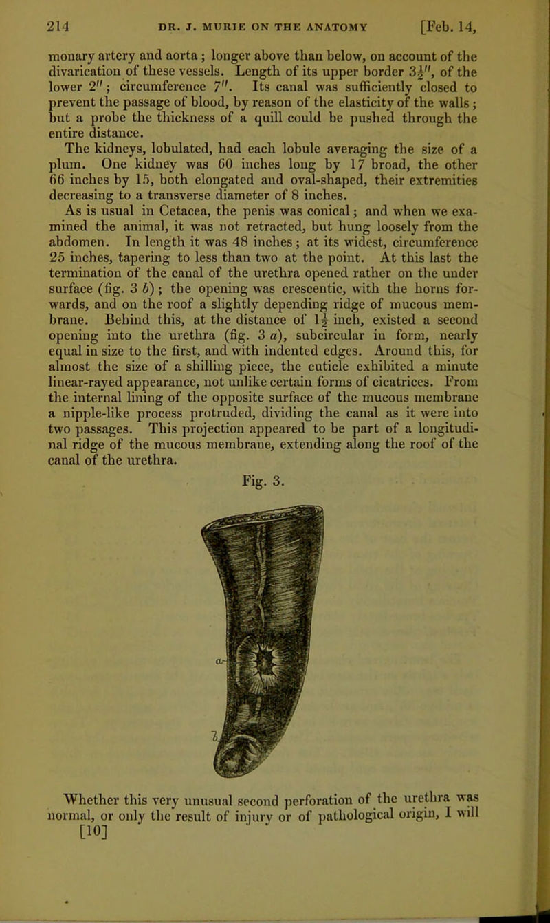 monury artery and aorta; longer above than below, on account of the divarication of these vessels. Length of its upper border 3|, of the lower 2; circumference 7. Its canal was sufficiently closed to prevent the passage of blood, by reason of the elasticity of the walls ; but a probe the thickness of a quill could be pushed through the entire distance. The kidneys, lobulated, had each lobule averaging the size of a plum. One kidney was GO inches long by 17 broad, the other 66 inches hy 15, both elongated and oval-shaped, their extremities decreasing to a transverse diameter of 8 inches. As is usual in Cetacea, the penis was conical; and when we exa- mined the animal, it was not retracted, but hung loosely from the abdomen. In length it was 48 inches ; at its widest, circumference 25 inches, tapering to less than two at the point. At this last the termination of the canal of the urethra opened rather on the under surface (fig. 3 b) ; the opening was crescentic, with the horns for- wards, and on the roof a slightly depending ridge of mucous mem- brane. Behind this, at the distance of 1| inch, existed a second opening into the urethra (fig. 3 a), subcircular in form, nearly equal in size to the first, and with indented edges. Around this, for almost the size of a shilling piece, the cuticle exhibited a minute linear-rayed appearance, not unlike certain forms of cicatrices. From the internal lining of the opposite surface of the mucous membrane a nipple-like process protruded, dividing the canal as it were into two passages. This projection appeared to be part of a longitudi- nal ridge of the mucous membrane, extending along the roof of the canal of the urethra. Fig. 3. Whether this very unusual second perforation of the urethra was normal, or only the result of injury or of pathological origin, I will [10]