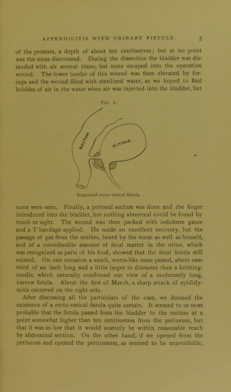 of the prostate, a depth of about ten centimetres; but at no point was the sinus discovered. During the dissection the bladder was dis- tended with air several times, but none escaped into the operation wound. The lower border of this wound was then elevated by for- ceps and the wound filled with sterilized water, as we hoped to find bubbles of air in the water when air was injected into the bladder, but Fig. i. Supposed recto-vesical fistula. none were seen. Finally, a perineal section was done and the finger introduced into the bladder, but nothing abnormal could be found by touch or sight. The wound was then packed with iodoform gauze and a T bandage applied. He made an excellent recovery, but the passage of gas from the urethra, heard by the nurse as well as himself, and of a considerable amount of fecal matter in the urine, which was recognized as parts of his food, showed that the fecal fistula still existed. On one occasion a small, worm-like mass passed, about one- third of an inch long and a little larger in diameter than a knitting- needle, which naturally confirmed our view of a moderately long, narrow fistula. About the first of March, a sharp attack of epididy- mitis occurred on the right side. After discussing all the particulars of the case, we deemed the existence of a recto-vesical fistula quite certain. It seemed to us most probable that the fistula passed from the bladder to the rectum at a point somewhat higher than ten centimetres from the perineum, but that it was so low that it would scarcely be within reasonable reach by abdominal section. On the other hand, if we opened from the perineum and opened the peritoneum, as seemed to be unavoidable,