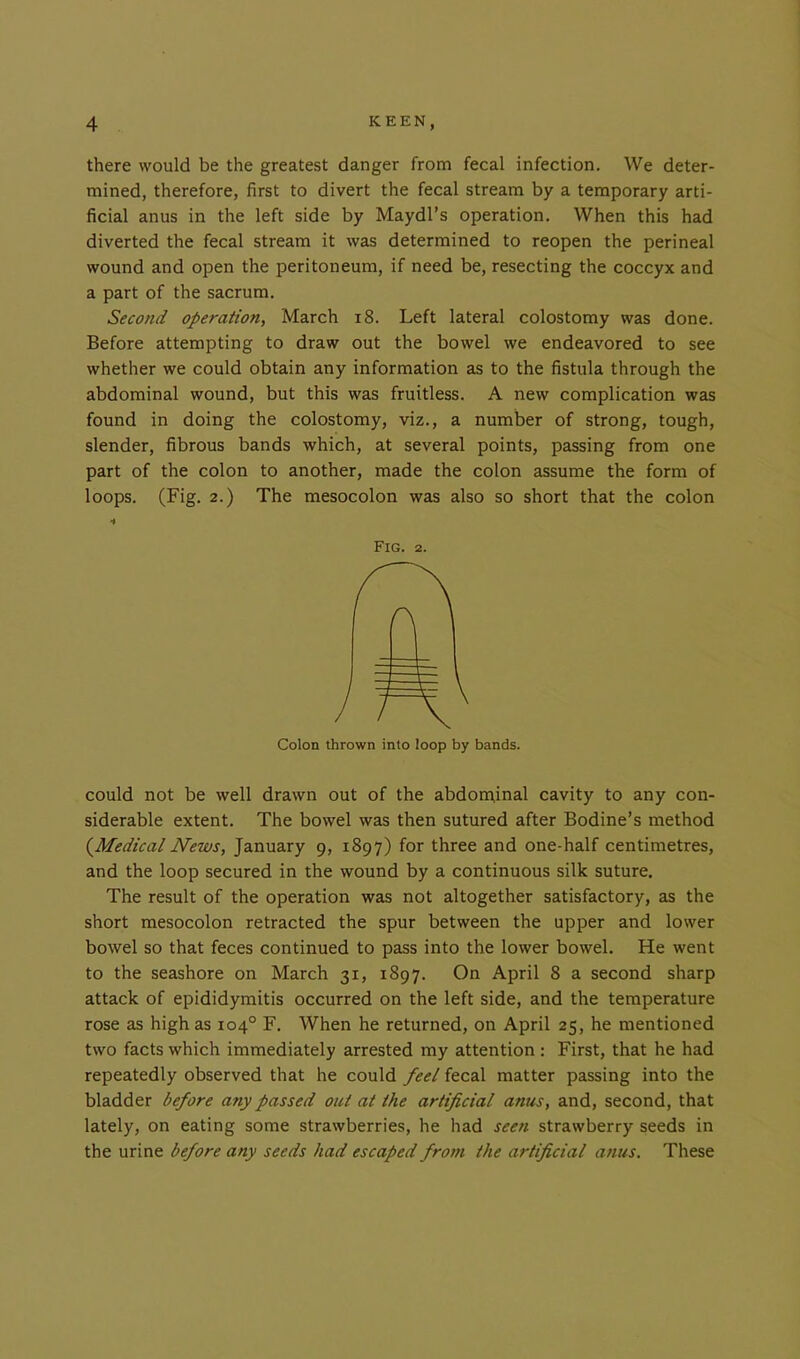 there would be the greatest danger from fecal infection. We deter- mined, therefore, first to divert the fecal stream by a temporary arti- ficial anus in the left side by Maydl’s operation. When this had diverted the fecal stream it was determined to reopen the perineal wound and open the peritoneum, if need be, resecting the coccyx and a part of the sacrum. Second operation, March 18. Left lateral colostomy was done. Before attempting to draw out the bowel we endeavored to see whether we could obtain any information as to the fistula through the abdominal wound, but this was fruitless. A new complication was found in doing the colostomy, viz., a number of strong, tough, slender, fibrous bands which, at several points, passing from one part of the colon to another, made the colon assume the form of loops. (Fig. 2.) The mesocolon was also so short that the colon Fig. 2. Colon thrown into loop by bands. could not be well drawn out of the abdominal cavity to any con- siderable extent. The bowel was then sutured after Bodine’s method (.Medical News, January 9, 1897) for three and one-half centimetres, and the loop secured in the wound by a continuous silk suture. The result of the operation was not altogether satisfactory, as the short mesocolon retracted the spur between the upper and lower bowel so that feces continued to pass into the lower bowel. He went to the seashore on March 31, 1897. On April 8 a second sharp attack of epididymitis occurred on the left side, and the temperature rose as high as 104° F. When he returned, on April 25, he mentioned two facts which immediately arrested my attention : First, that he had repeatedly observed that he could feel fecal matter passing into the bladder before any passed out at the artificial anus, and, second, that lately, on eating some strawberries, he had seen strawberry seeds in the urine before any seeds had escaped from the artificial anus. These