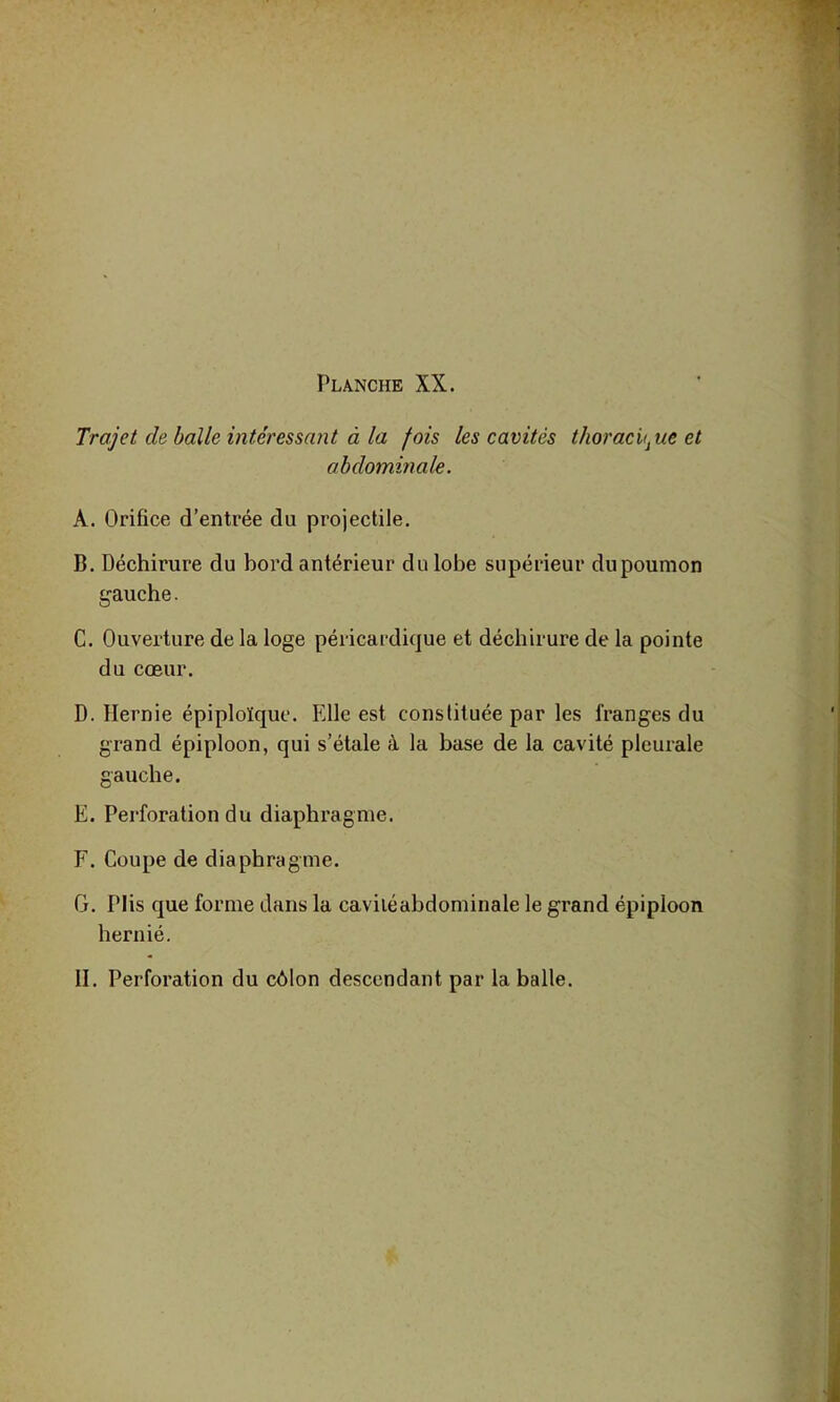 Trajet de balle intéressant à la fois les cavités thoracique et abdominale. A. Orifice d’entrée du projectile. B. Déchirure du bord antérieur du lobe supérieur dupoumon gauche. C. Ouverture de la loge péricardique et déchirure de la pointe du cœur. D. Hernie épiploïque. Elle est constituée par les franges du grand épiploon, qui s’étale à la base de la cavité pleurale gauche. E. Perforation du diaphragme. F. Coupe de diaphragme. G. Plis que forme dans la caviléabdominale le grand épipioon hernié. II. Perforation du côlon descendant par la balle.