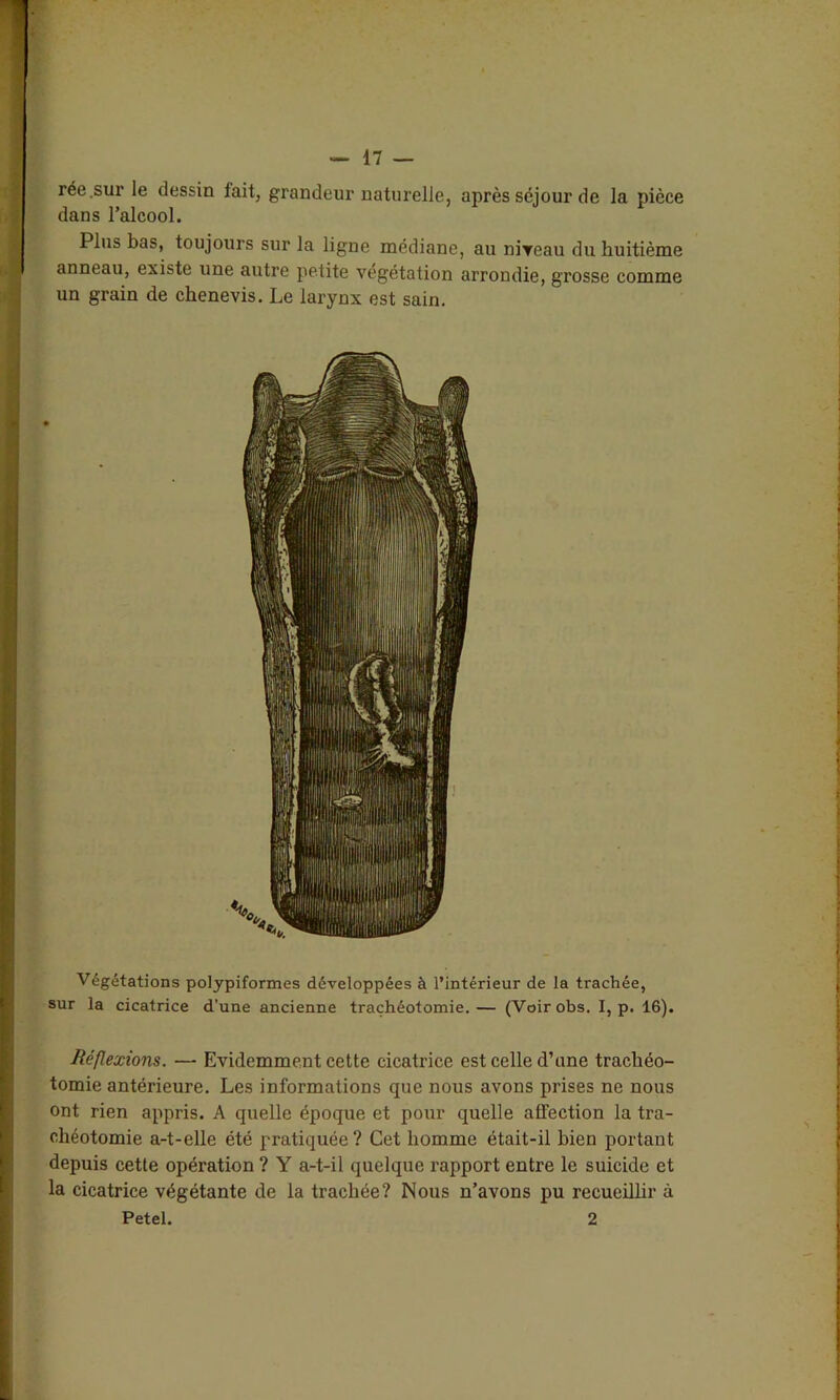 rée .sur le dessin fait, grandeur naturelle, après séjour de la pièce dans l’alcool. Plus bas, toujours sur la ligne médiane, au niveau du huitième anneau, existe une autre petite végétation arrondie, grosse comme un grain de chenevis. Le larynx est sain. Végétations polypiformes développées à l’intérieur de la trachée, sur la cicatrice d’une ancienne trachéotomie.— (Voirobs. I, p. 16). Réflexions. — Evidemment cette cicatrice est celle d’une trachéo- tomie antérieure. Les informations que nous avons prises ne nous ont rien appris. A quelle époque et pour quelle affection la tra- chéotomie a-t-elle été pratiquée? Cet homme était-il bien portant depuis cette opération ? Y a-t-il quelque rapport entre le suicide et la cicatrice végétante de la trachée? Nous n’avons pu recueillir à Petel. 2