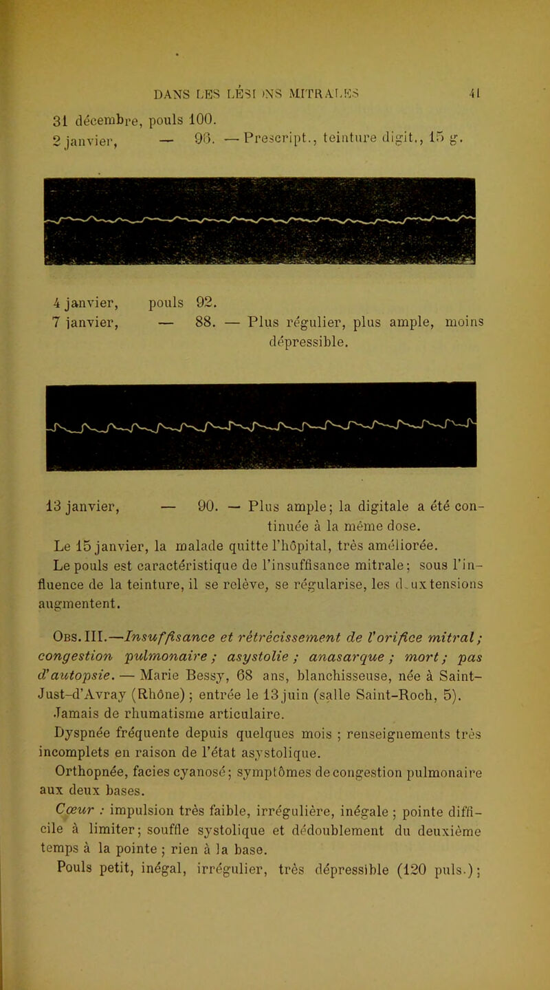 31 décembre, pouls 100. 2 janvier, — 90. — Preâcript., teinture digit,, 15 g. 4 janvier, pouls 92. 7 janvier, — 88. — Plus régulier, plus ample, moins dépressible. 13 janvier, — 90. — Plus ample; la digitale a été con- tinuée à la même dose. Le 15 janvier, la malade quitte l’hôpital, très améliorée. Le pouls est caractéristique de l’insuffisance mitrale; sous l’in- fluence de la teinture, il se relève, se régularise, les d.uxtensions augmentent. Obs.III.—Insuffisance et rétrécissement de l'orifice mitral; congestion 'pulmonaire; asystolie ; anasarque ; mort; pas d’autopsie. — Marie Bessy, 68 ans, blanchisseuse, née à Saint- Just-d’Avray (Rhône) ; entrée le 13juin (salle Saint-Roch, 5). Jamais de rhumatisme articulaire. Dyspnée fréquente depuis quelques mois ; renseignements très incomplets en raison de l’état asystolique. Orthopnée, faciès cyanosé; symptômes de congestion pulmonaire aux deux bases. Cœur : impulsion très faible, irrégulière, inégale ; pointe diffi- cile à limiter; souffle systolique et dédoublement du deuxième temps à la pointe ; rien à la base. Pouls petit, inégal, irrégulier, très dépressible (120 puis.);