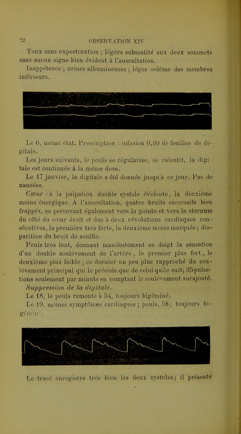 Toux sans expectoration ; légère submatité aux deux sommets sans aucun signe bien évident à l’auscultation. Inappétence ; urines albumineuses ; léger œdème des membres inférieurs. Le 6, même état. Prescription : infusion 0,30 de feuilles de di- gitale. Les jours suivants, le pouls se régularise, se ralentit, la digi - taie est continuée à la même dose. Le 17 janvier, la digitale a été donnée juscpi'à ce jour. Pas de nausées. Cœur : k la palpation double systole évidente, la deuxième moins énergique. A l’auscultation, quatre bruits successifs bien frappés, se percevant également vers la pointe et vers le sternum du côté du cœur droit et dus à deux révolutions cardiaques con- sécutives, la première très forte, la deuxième moins marquée ; dis- parition du bruit de souffle. Pouls très lent, donnant manifestement au doigt la sensation d’un double soulèvement de l’artère , le premier plus fort, le deuxième plus faible ; ce dernier un peu plus rapproché du sou- lèvement principal qui le précède que de celui quile suit; 35pulsa- tions seulement par minute en comptant le soulèvement surajouté. Suppression de la digitale. Le 18, le pouls remonte à 54, toujours bigéminé. Le 19, mêmes symptômes cardiaques ; pouls, 58; toujours bi- gémin'. Le tracé enregistre très bien les deux systoles; il présente