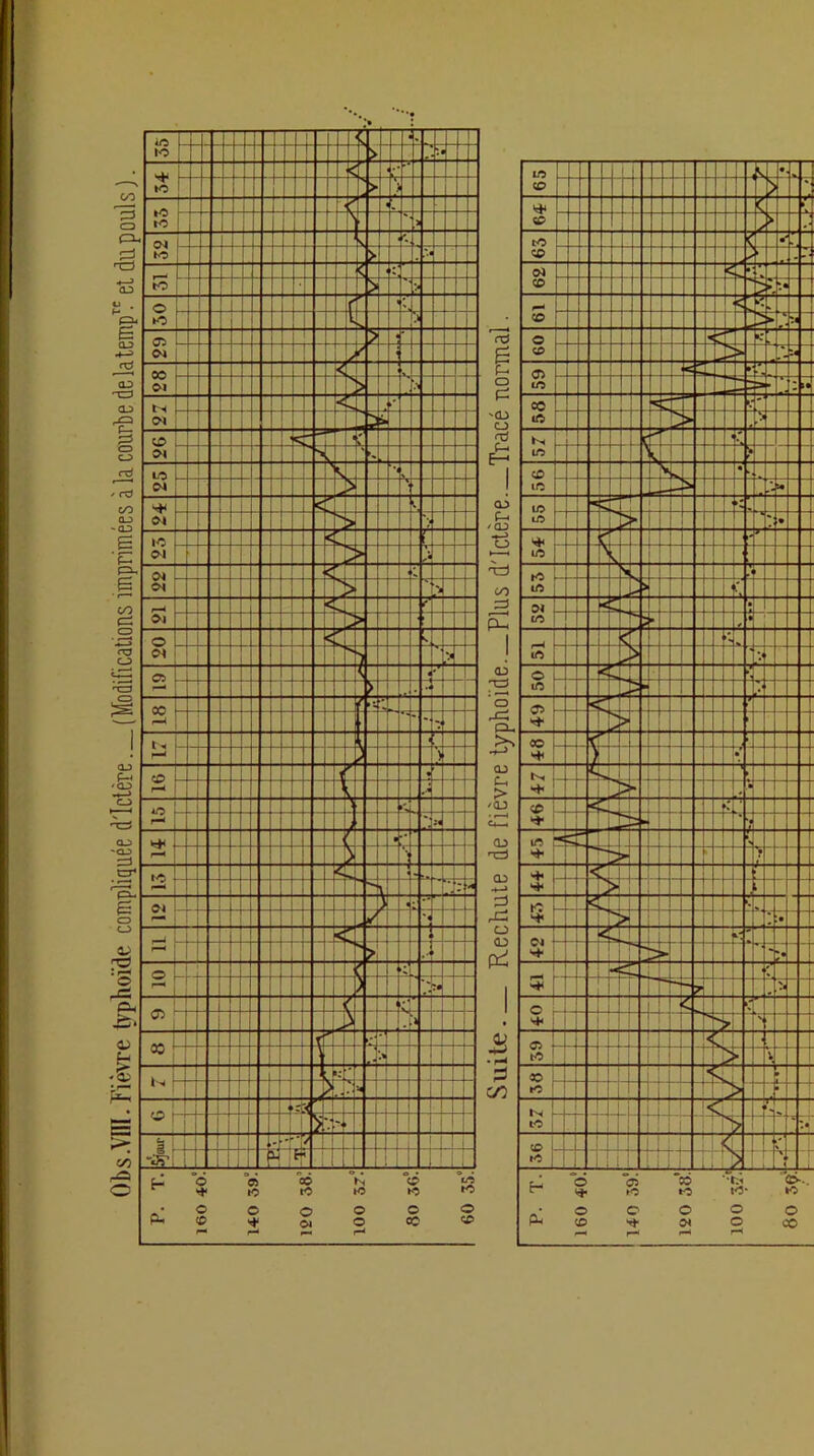 Obs .Vni. Fièvre typhoïde compliquée d'ictère (Modifications imprimées à la courbe de latempT.c et du pouls ).