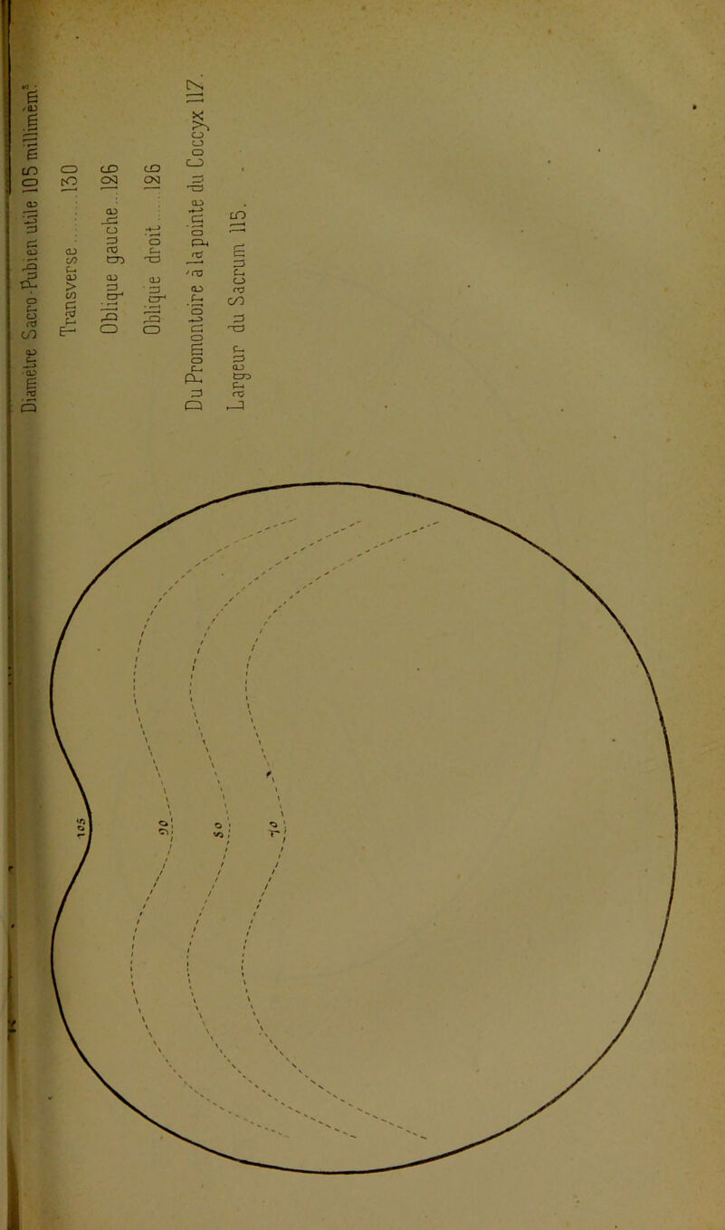 Diamètre Sacro-Pubien utile 105 miïlimèm5 *—’ 'TJ QJ) eu i—! +-> • m ' < .s m CL) œ Ç-* a-> e ro CD QJ O fU nzJ aj PU «X? 'rc Ë Z-> tu O > ■ es 0J Cj en te ra te Cr* S CT1 Zo {U O oo e E- CD CD te O tD Ë (U O d te QJ) Pu CD te e rO Q -3