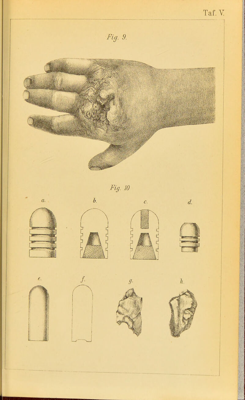 Füj. 9. Fig. 10 - ~J