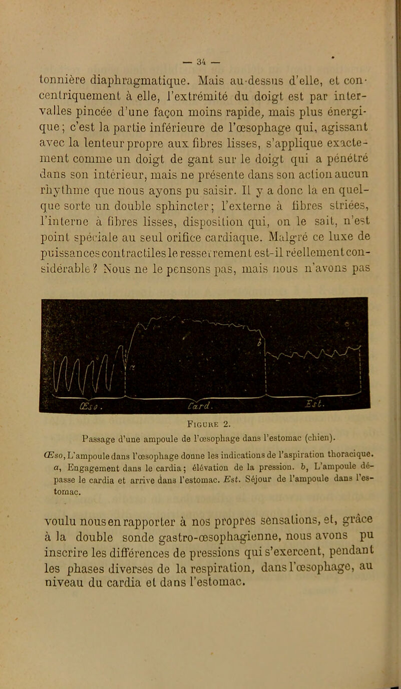 tonnière diaphragmatique. Mais au-dessus d’elle, et con- centriquement à elle, l’extrémité du doigt est par inter- valles pincée d’une façon moins rapide, mais plus énergi- que; c’est la partie inférieure de l’œsophage qui, agissant avec la lenteur propre aux fibres lisses, s’applique exacte- ment comme un doigt de gant sur le doigt qui a pénétré dans son intérieur, mais ne présente dans son action aucun rhythme que nous ayons pu saisir. Il y a donc la en quel- que sorte un double sphincter; l’externe à libres striées, l’interne à fibres lisses, disposition qui, on le sait, n’est point spéciale au seul orifice cardiaque. Malgré ce luxe de puissances contractiles le resserrement est-il réellement con- sidérable? Nous ne le pensons pas, mais nous n’avons pas Figure 2. Passage d’une ampoule de l’oesophage dans l’estomac (chien). Œso, L'ampoule dans l’œsophage donne les indications de l’aspiration thoracique, a, Engagement dans le cardia; élévation de la pression, b, L’ampoule dé- passe le cardia et arrive dan3 l’estomac. Est. Séjour de l’ampoule dans 1 es- tomac. voulu nous en rapporter à nos propres sensations, et, grâce à la double sonde gastro-œsophagienne, nous avons pu inscrire les différences de pressions qui s’exercent, pendant les phases diverses de la respiration, dans l’œsophage, au niveau du cardia et dans l’estomac.