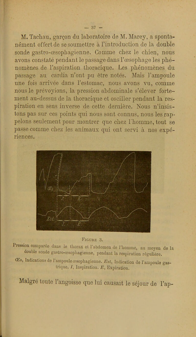 M. Tacliau, garçon du laboratoire de M. Marey, a sponta- nément offert de se soumettre à l’introduction de la double sonde gastro-œsophagienne. Comme chez le chien, nous avons constaté pendant le passage dans l’œsophage les phé- nomènes de l’aspiration thoracique. Les phénomènes du passage au cardia n’ont pu être notés. Mais l’ampoule une fois arrivée dans l’estomac, nous avons vu, comme nous le prévoyions, la pression abdominale s’élever forte- ment au-dessus de la thoracique et osciller pendant la res- piration en sens inverse de cette dernière. Nous n’insis- tons pas sur ces points qui nous sont connus, nous les rap - pelons seulement pour montrer que chez l'homme, tout se passe comme chez les animaux qui ont servi à nos expé- riences. Figure 3. Pression comparée dans le thorax et l'abdomen de l’homme, au moyen de la double sonde gastro-œsophagienne, pendant la respiration régulière. Œs, Indications de l'ampoule œsophagienne. Est, Indication de l'ampoule gas- trique. I, Inspiration. E, Expiration. Malgié toute 1 angoisse que lui causait le séjour de l’ap-