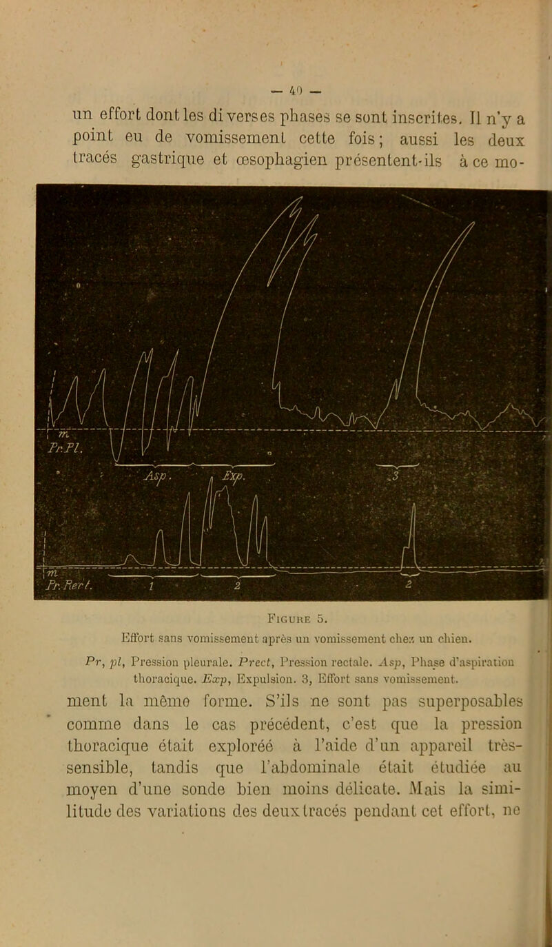 un effort dont les diverses phases se sont inscrites. Il n’y a point eu de vomissement cette fois; aussi les deux tracés gastrique et œsophagien présentent-ils àcemo- Figure 5. Effort sans vomissement après un vomissement cher, un chien. Pr, pl, Pression pleurale. Prect, Pression rectale. Asp, Phase d’aspiration thoracique. Eocp, Expulsion. 3, Effort sans vomissement. ment la même forme. S’ils ne sont pas superposables comme dans le cas précédent, c’est que la pression thoracique était exploréé à l’aide d’un appareil très- sensible, tandis que l’abdominale était étudiée au moyen d’une sonde bien moins délicate. Mais la simi- litude des variations des deux tracés pendant cet effort, ne