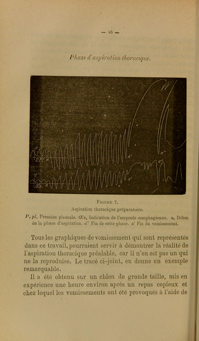 Phase d'aspiration thoracique. Figure 7. Aspiration thoracique préparatoire. P, pl, Pression pleurale. Œs, Indication de l’ampoule œsophagienne, a, Début de la phase d’aspiration, a’’ Fin de cette phase, a Fin du vomissement. Tons les graphiques de vomissement qui sont représentés dans ce travail, pourraient servir à démontrer la réalité de l’aspiration thoracique préalable, car il n’en est pas un qui ne la reproduise. Le tracé ci-joint, en donne un exemple remarquable. Il a été obtenu sur un chien de grande taille, mis en expérience une heure environ après un repas copieux et chez lequel les vomissements ont été provoqués à l’aide de