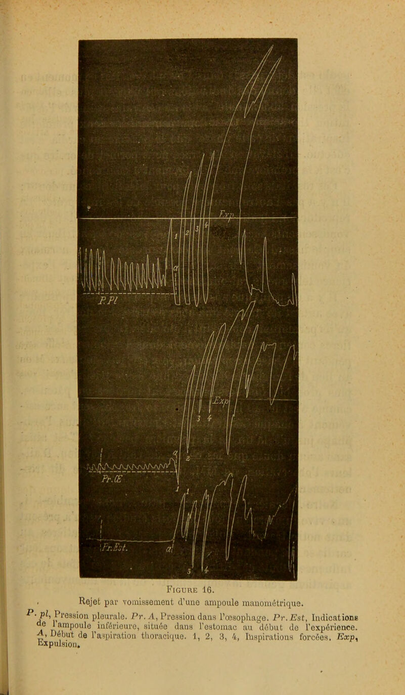 Figure 16. . Rejet par vomissement d’une ampoule mauométrique. £*• pi, Pression pleurale. Pr. A, Pression dans l’œsophage. Pr.Est, Indications a ^îinipoule inférieure, située dans l’estomac au début de l'expérience. . Début de l’aspiration thoracique. 1, 2, 3, 4, Inspirations forcées. Exp, Expulsion.