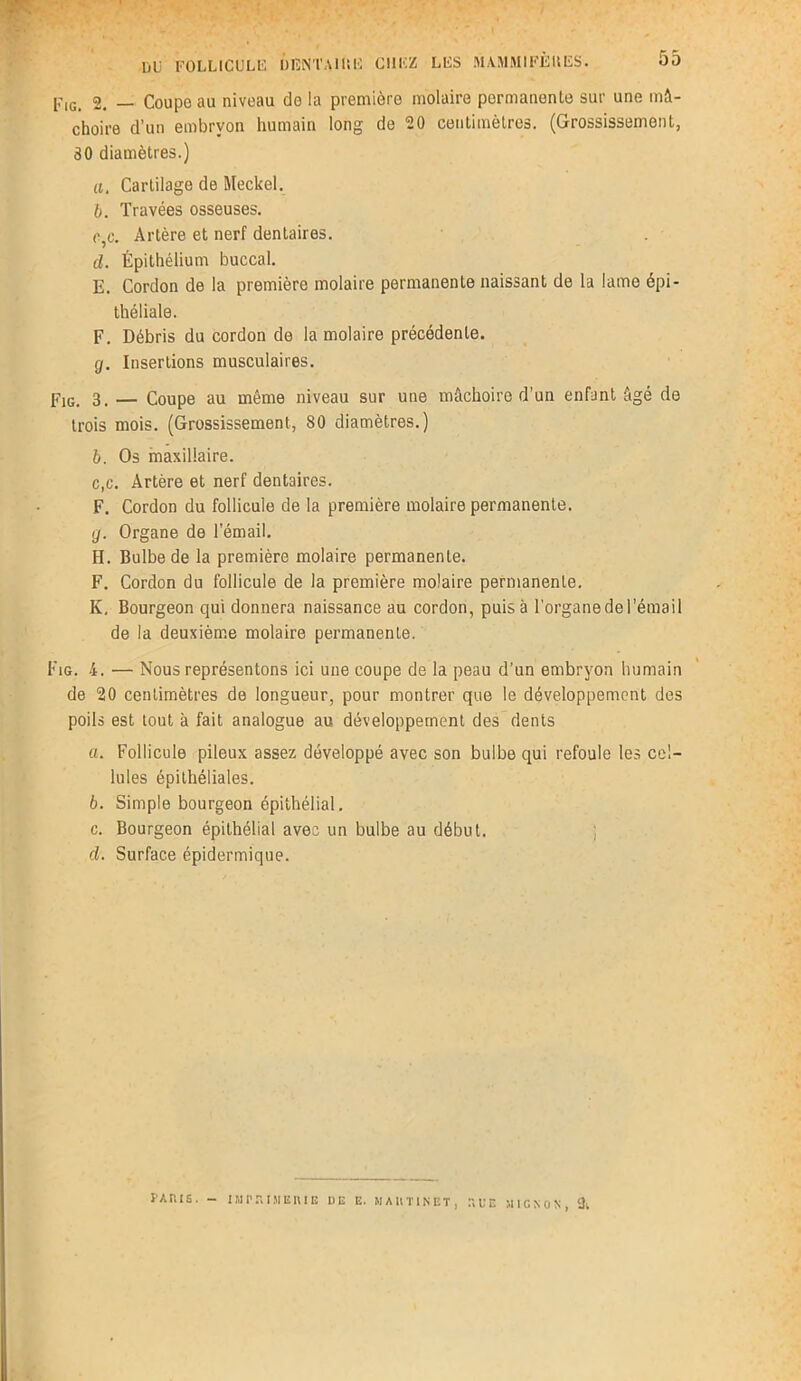. p1Gi 2. — Coupo au niveau do la première molaire permanonte sur une mâ- choire d’un embryon humain long do 20 centimètres. (Grossissement, 30 diamètres.) a. Cartilage de Meckel. b. Travées osseuses. e,c. Artère et nerf dentaires. d. Épithélium buccal. E. Cordon de la première molaire permanente naissant de la lame épi- théliale. F. Débris du cordon de la molaire précédente. cj. Insertions musculaires. Fig. 3, — Coupe au même niveau sur une mâchoire d’un enfant âgé de trois mois. (Grossissement, 80 diamètres.) b. Os maxillaire. c, c. Artère et nerf dentaires. F. Cordon du follicule de la première molaire permanente. g. Organe de l’émail. H. Bulbe de la première molaire permanente. F. Cordon du follicule de la première molaire permanente. K. Bourgeon qui donnera naissance au cordon, puisa l’organe de l'émail de la deuxième molaire permanente. Fig. 4. — Nous représentons ici une coupe de la peau d’un embryon humain de 20 centimètres de longueur, pour montrer que le développement des poils est tout à fait analogue au développement des dents a. Follicule pileux assez développé avec son bulbe qui refoule les cel- lules épithéliales. b. Simple bourgeon épithélial. c. Bourgeon épithélial avec un bulbe au début. d. Surface épidermique. FAU1S. - IMPHIJIEIUE DE E. MA U Tl K ET, EUE MIGNON, 3t