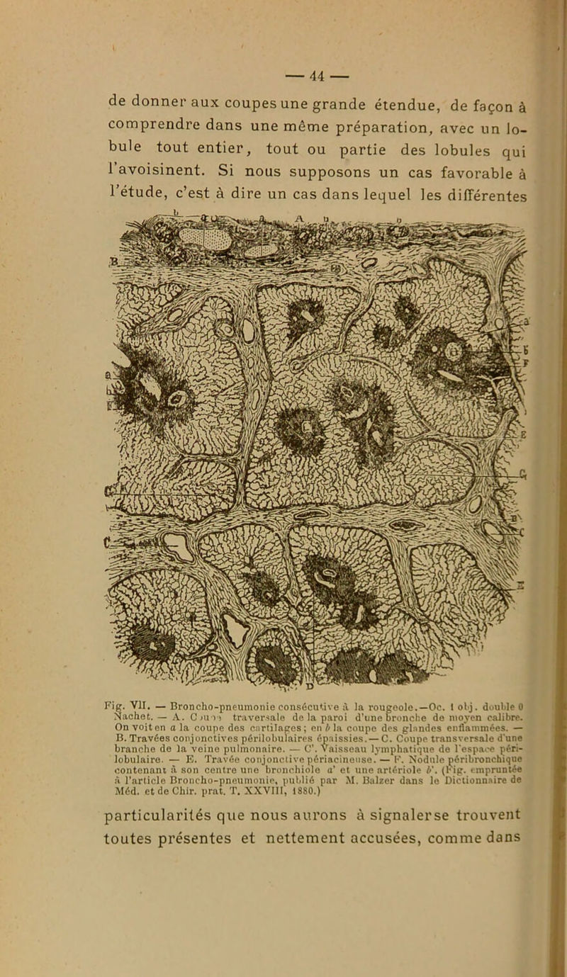 de donner aux coupes une grande étendue, de façon à comprendre dans une même préparation, avec un lo- bule tout entier, tout ou partie des lobules qui 1 avoisinent. Si nous supposons un cas favorable à l’étude, c’est à dire un cas dans lequel les différentes Fig. VII. — Broncho-pneumonie consécutive à la rougeole.—Oc. 1 obj. double 0 Nachet. — A. Ciun traversale de la paroi d’une bronche de moyen calibre. On voit en a la coupe des cartilages; en b la coupe des glandes enflammées. — B. Travées conjonctives périlobulaires épaissies. — C. Coupe transversale d'une branche de la veine pulmonaire. — C. Vaisseau lymphatique de l'espace péri- lobulaire. — E. Travée conjonctivepériacineuse.— F. Nodule péribronchique contenant à son centre une bronchiole a' et une artériole b'. (Fig. empruntée à l’article Broncho-pneumonie, publié par M. Balzer dans le Dictionnaire de Méd. et de Cliir. prat. T. XXVIII, 1880.) particularités que nous aurons à signalerse trouvent toutes présentes et nettement accusées, comme dans