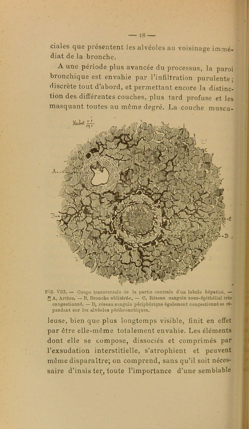 — 18 — ciales que présentent les alvéoles au voisinage immé- diat de la bronche. A une période plus avancée du processus, la paroi bronchique est envahie par l’infiltration purulente; discrète tout d’abord, et permettant encore la distinc- tion des différentes couches, plus tard profuse et les masquant toutes au même degré. La couche muscu- Fig. VIII. — Coupe transversale Je la partie centrale d’un lobule hépatisé. — £A, Artère. — B, Bronche oblitérée. — C, Réseau sanguin sous-épithélial très congestionné. — D, réseau sanguin périphérique également congestionné se ré- pandant sur les alvéoles péribronchiques. leuse, bien que plus longtemps visible, finit en effet par être elle-même totalement envahie. Les éléments dont elle se compose, dissociés et comprimés par l’exsudation interstitielle, s’atrophient et peuvent même disparaître; on comprend, sans qu’il soit néces- saire d’insis ter, toute l’importance d’une semblable