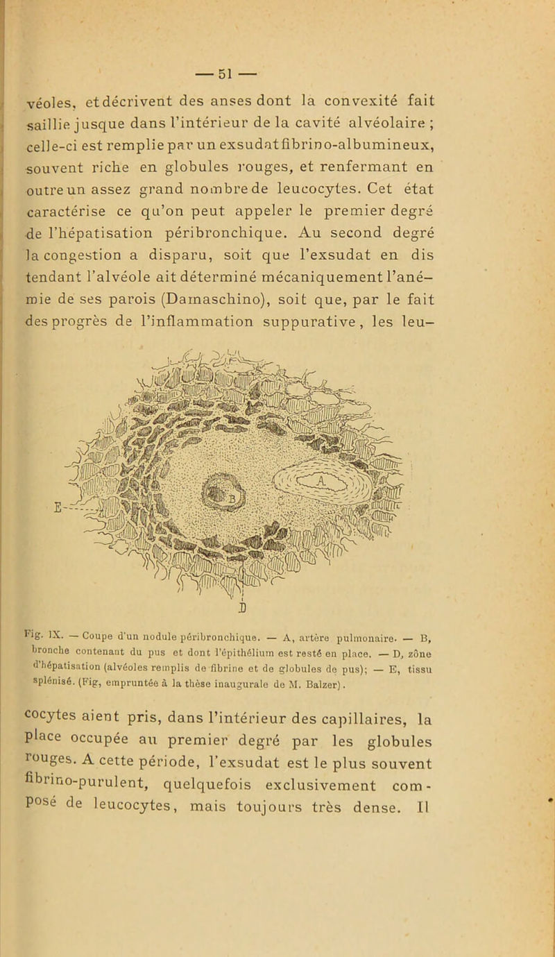 véoles, et décrivent des anses dont la convexité fait saillie jusque dans l’intérieur de la cavité alvéolaire ; celle-ci est remplie par un exsudatfibrino-albumineux, souvent riche en globules rouges, et renfermant en outreun assez grand nombre de leucocytes. Cet état caractérise ce qu’on peut appeler le premier degré de l’hépatisation péribronchique. Au second degré la congestion a disparu, soit que l’exsudât en dis tendant l’alvéole ait déterminé mécaniquement l’ané- mie de ses parois (Daxnaschino), soit que, par le fait des progrès de l’inflammation suppurative, les leu- Fig. IX. —Coupe d un nodule péribronchique. — A, artère pulmonaire. — B, bronche contenant du pus et dont l’épithélium est resté en place. — D, zone d hépatisation (alvéoles remplis de fibrine et de globules de pus); — E, tissu splénisé. (Fig, empruntée à la thèse inaugurale de M. Balzer). cocytes aient pris, dans l’intérieur des capillaires, la place occupée au premier degré par les globules rouges. A cette période, l’exsudât est le plus souvent fibrino-purulent, quelquefois exclusivement com- posé de leucocytes, mais toujours très dense. Il