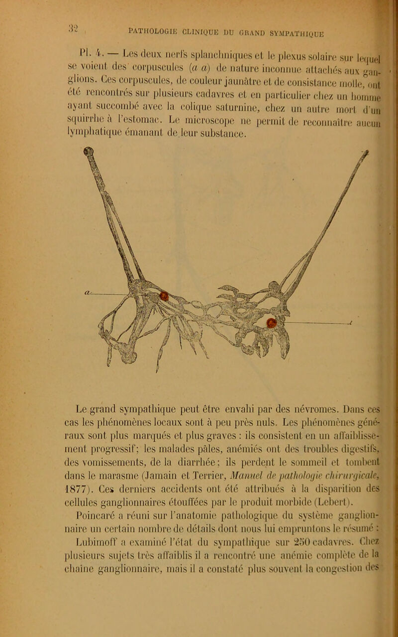 IM. 4. — Les deux nerfs splanchniques el le plexus solaire sur leijuel se voient des' corpuscules (a a) de nature inconnue attachés aux gau- plions. Ces corpuscules, de couleur jaunâtre et de consistance molle, ont été rencontrés sur plusieurs cadavres et en particulier chez un homme ayant succombé avec la colique saturnine, chez un autre mort d'un squinhe a l estomac. Le microscope ne permit de reconnaître aucun lymphatique émanant de.leur substance. Le grand sympathique peut être envahi par des névromes. Dans ces cas les phénomènes locaux sont à peu près nuis. Les phénomènes géné- raux sont plus marqués et plus graves : ils consistent en un affaiblisse- ment progressif; les malades pâles, anémiés ont des troubles digestifs, des vomissements, de la diarrhée : ils perdent le sommeil et tombent dans le marasme (Jamain et Terrier, Manuel de pathologie chirurgicale, 1877). Ces derniers accidents ont été attribués à la disparition dc-s cellules ganglionnaires étouffées par le produit morbide (Lcbert). Poincaré a réuni sur l’anatomie pathologique du système ganglion- naire un certain nombre de détails dont nous lui empruntons le résumé : Lubimoff a examiné l’état du sympathique sur 250 cadavres. Chez plusieurs sujets très affaiblis il a rencontre une anémie complète de la chaîne ganglionnaire, mais il a constaté plus souvent la congeslion des