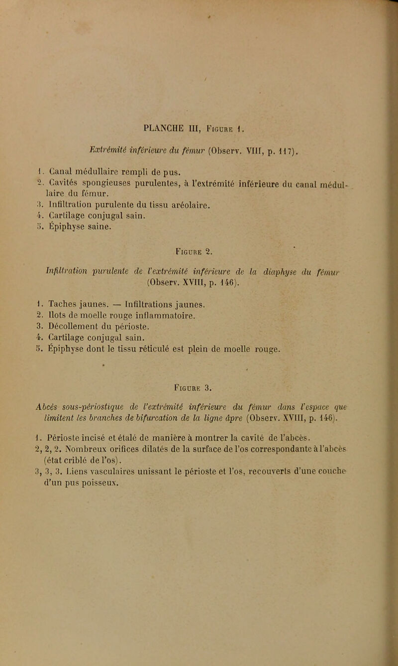 Extrémité inférieure du fémur (Oliserv. VIII, p. H7). I. Canal médullaire rempli de pus. -• Cavités spongieuses purulentes, à l’extrémité inférieure du canal médul- laire du fémur. 3. Infiltration purulente du tissu aréolaire. 4. Cartilage conjugal sain, o. Épiphyse saine. Figure 2. Infiltration purulente de l’extrémité inférieure de la diaphyse du fémur (Observ. XVIII, p. 146). 1. Taches jaunes. — Infiltrations jaunes. 2. Ilots de moelle rouge inflammatoire. 3. Décollement du périoste. 4. Cartilage conjugal sain. fi. Épiphyse dont le tissu réticulé est plein de moelle rouge. Figure 3. Abcès sous-périostique de l’extrémité inférieure du fémur dans l’espace que limitent les branches de bifurcation de la ligne âpre (Observ. XVIII, p. 146). J. Périoste incisé et étalé de manière à montrer la cavité de l’abcès. 2, 2, 2. Nombreux orifices dilatés de la surface de l’os correspondante à l’abcès (état criblé de l’os). 3, 3, 3. Liens vasculaires unissant le périoste et l’os, recouverts d’une couche d’un pus poisseux.