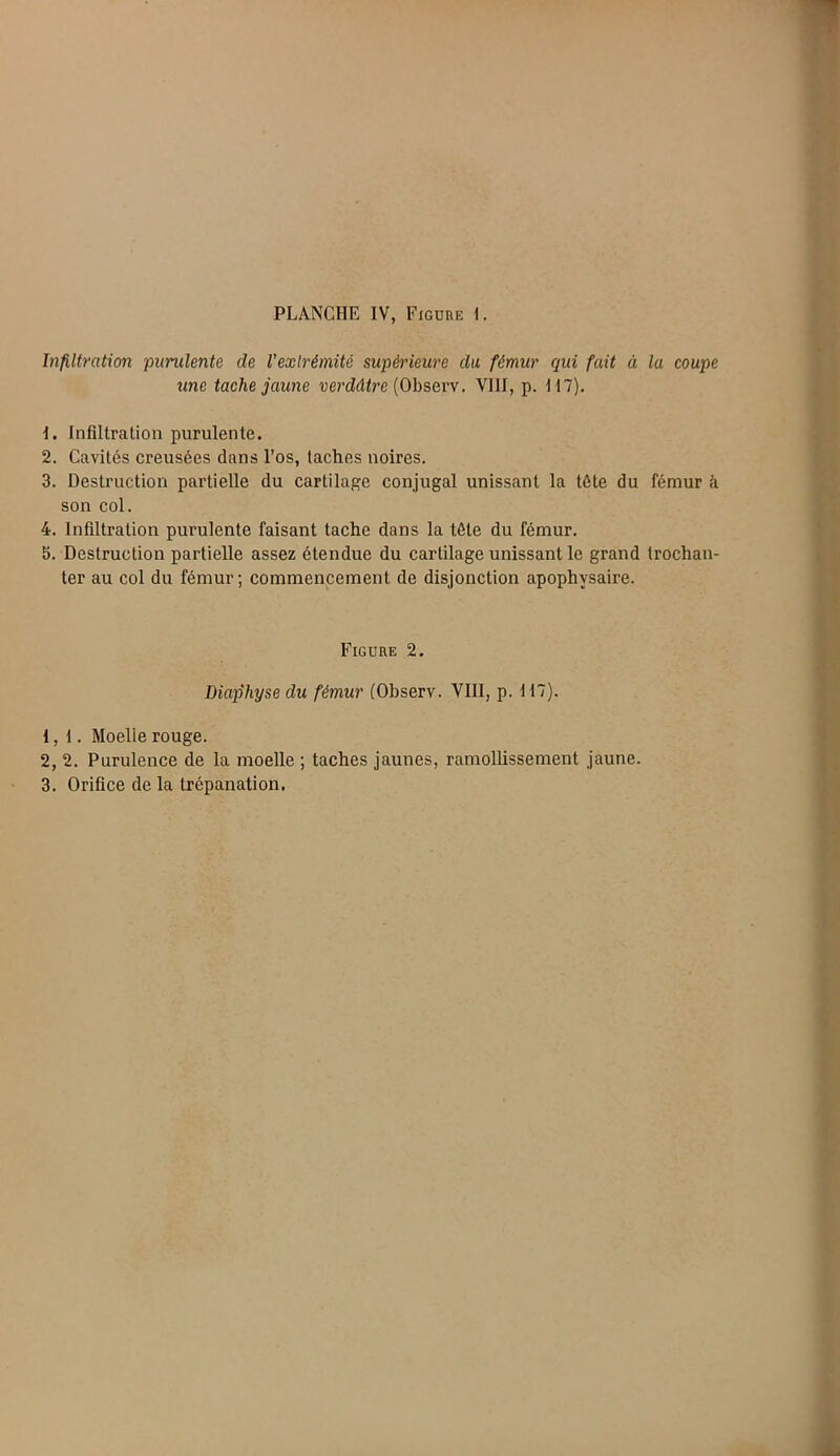 Infiltration purulente de l'extrémité supérieure du fémur qui fait à la coupe une tache jaune verdâtre (Observ. VIII, p. M7). 1. Infiltration purulente. 2. Cavités creusées dans l’os, taches noires. 3. Destruction partielle du cartilage conjugal unissant la tête du fémur à son col. 4. Infiltration purulente faisant tache dans la tête du fémur. 5. Destruction partielle assez étendue du cartilage unissant le grand trochan- ter au col du fémur; commencement de disjonction apophvsaire. Figure 2. Diaphyse du fémur (Observ. VIII, p. 117). 1,1. Moelie rouge. 2, 2. Purulence de la moelle ; taches jaunes, ramollissement jaune. 3. Orifice de la trépanation.