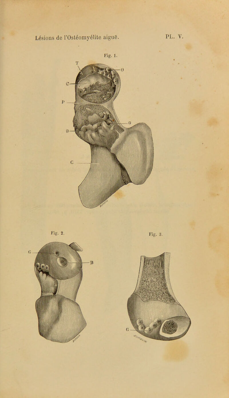 Fig. 1. Fig. 2. Fig. 3.