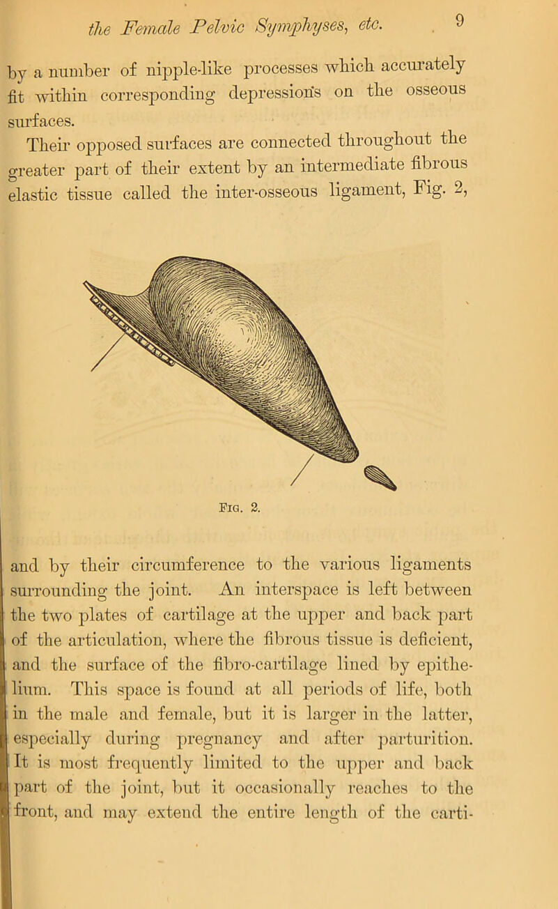 by a number of nipple-like processes which accurately fit within corresponding depressions on the osseous surfaces. Their opposed surfaces are connected throughout the greater part of their extent by an intermediate fibrous elastic tissue called the inter-osseous ligament, Fig. 2, Fig. 2. and by their circumference to the various ligaments surrounding the joint. An interspace is left between the two plates of cartilage at the upper and back part of the articulation, where the fibrous tissue is deficient, and the surface of the fibro-cartilage lined by epithe- lium. This space is found at all periods of life, both in the male and female, but it is larger in the latter, especially during pregnancy and after parturition. It is most frequently limited to the upper and back part of the joint, but it occasionally reaches to the front, and may extend the entire length of the carti-