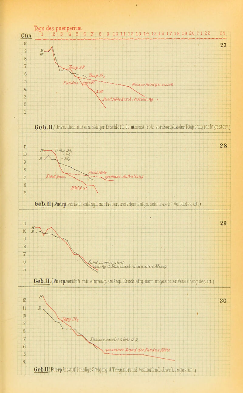 Clm io Tage des puerpernim 1 23*156789 10 11 12 13 14 15 1 6 1 7 18 19 20 11 22 24 Geb.II( JnYcMoninii einrDalicjer’ErscWaffgis.in^onsi trciz vorübeigeliender Temp.sreig rachT gestön.) Geb. II (Puerp .^arlänfr anfängi. mir Beb er, rr c t z dem anfgs.sehr rasche Verhldes ur.) Geb-IK Puerp bisauf 1 malige Sleigerg d.Temp.norrnal veriarufendr Jiwol.ungestcrr.)