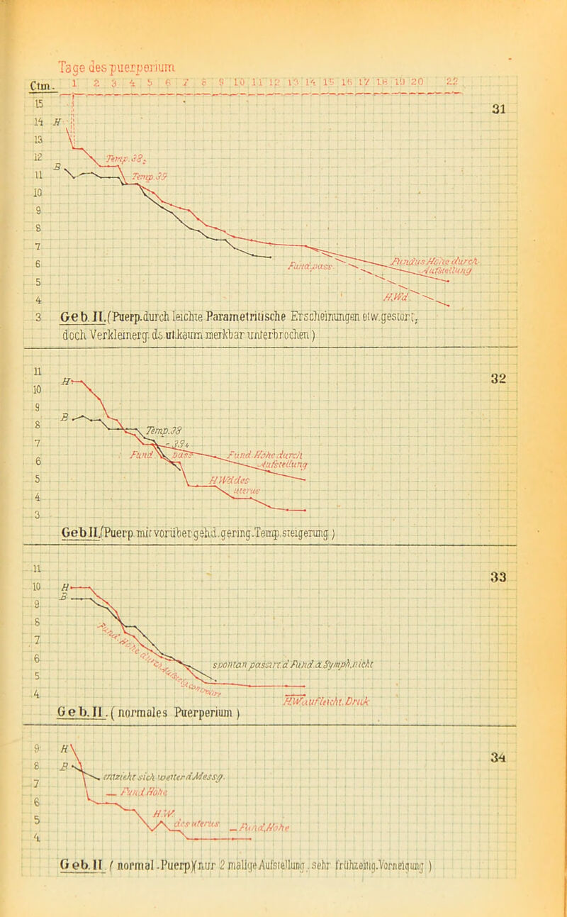 Ctin. 1 1 ' s io int»;ivi>« iv- ik. iv.ih .i‘.i so 22. ■ N> Geb.II.(normales Puerperium ) spontan passirr. a Fund. <3L Sy mph.n icht HWa yfleicht. Druk . tnlzif.hr sich ’veUerdMessp. _ p!/hd flii/hl ats «f'rus _fXJvi^hu 33 34 Geb. II f normal .Puerpynur 2 malige Aufstellung, sehr tr ühzeiJig. Vorn eig unj