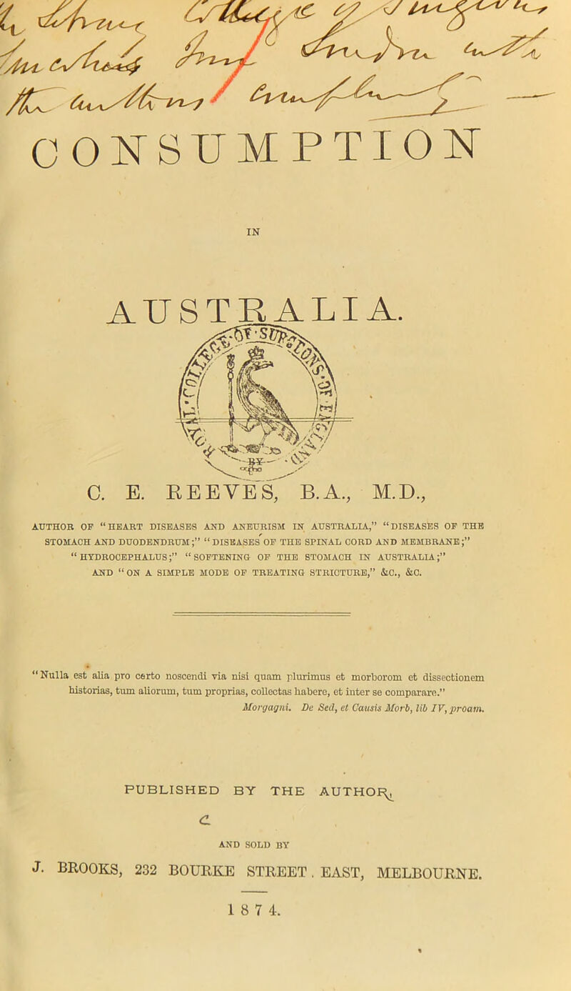 C. E. REEVES' B.A., M.D., AUTHOR OP “HEART DISEASES AND ANEURISM IN AUSTRALIA,” “DISEASES OP THE STOMACH AND DUODENDRUM;” “ DISEASESOF THE SPINAL CORD AND MEMBRANE;” “ HYDROCEPHALUS“ SOFTENING OP THE STOMACH IN AUSTRALIA AND “ ON A SIMPLE MODE OP TREATING STRICTURE,” JlC., &C. “Nulla est alia pro oerto noscendi via nisi quam plurimus et morborom et dissectionem historias, turn aliorum, turn proprias, colleotas habere, et inter se compaiare.” Morgagni. De Sell, el Causie Morb, lib IV, proam. PUBLISHED BY THE AUTHOR, £ AND SOLD BY J. BROOKS, 232 BOURKE STREET, EAST, MELBOURNE.